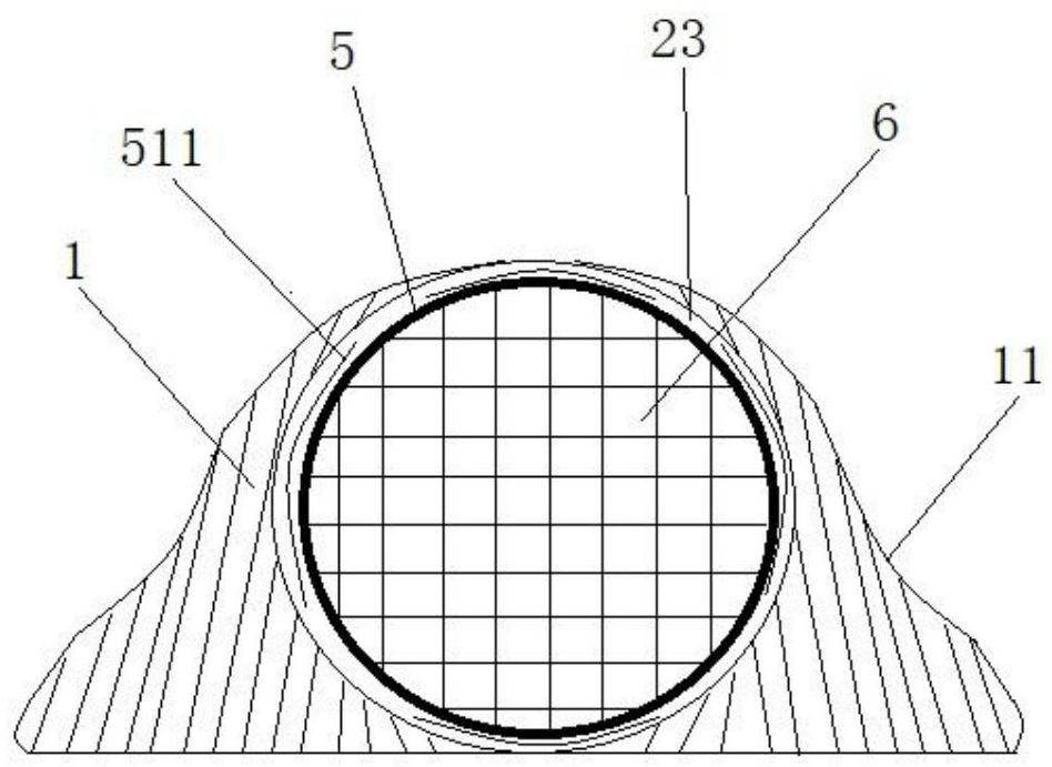 Novel deformable implantable infusion port and use method thereof