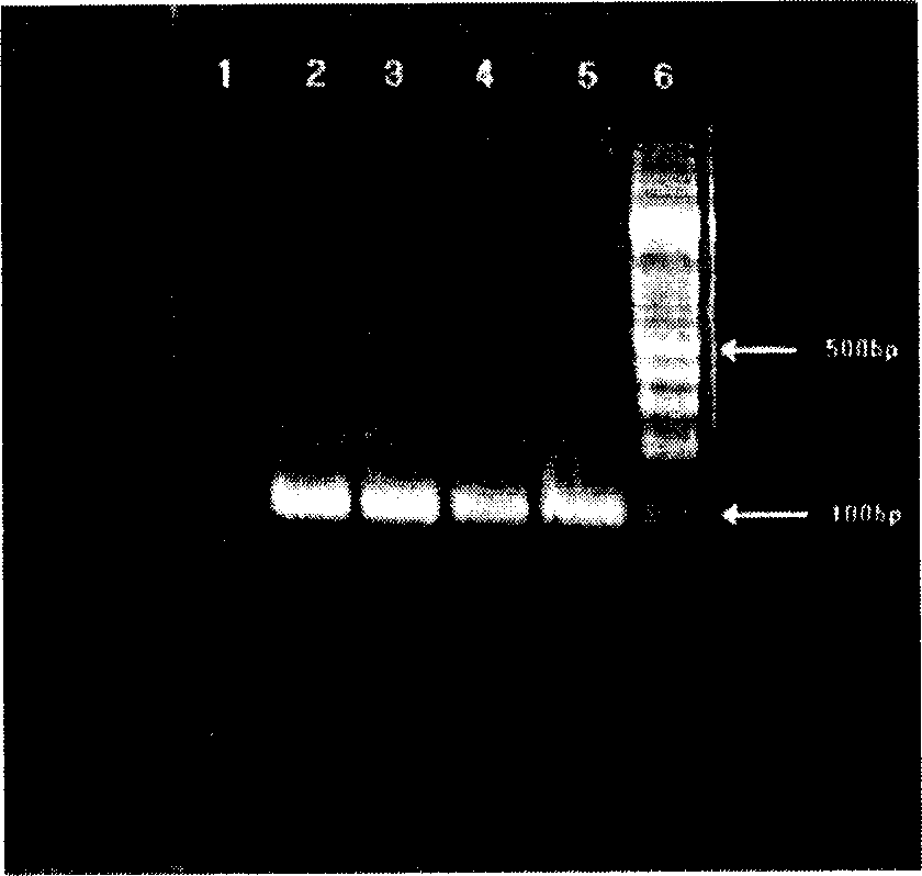 Method of expressing thymys peptide alpha by yeast and use thereof