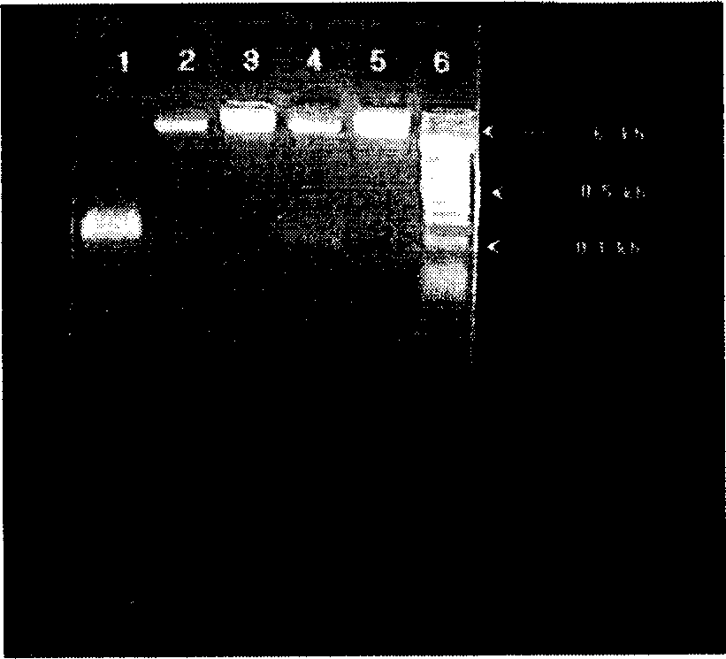 Method of expressing thymys peptide alpha by yeast and use thereof