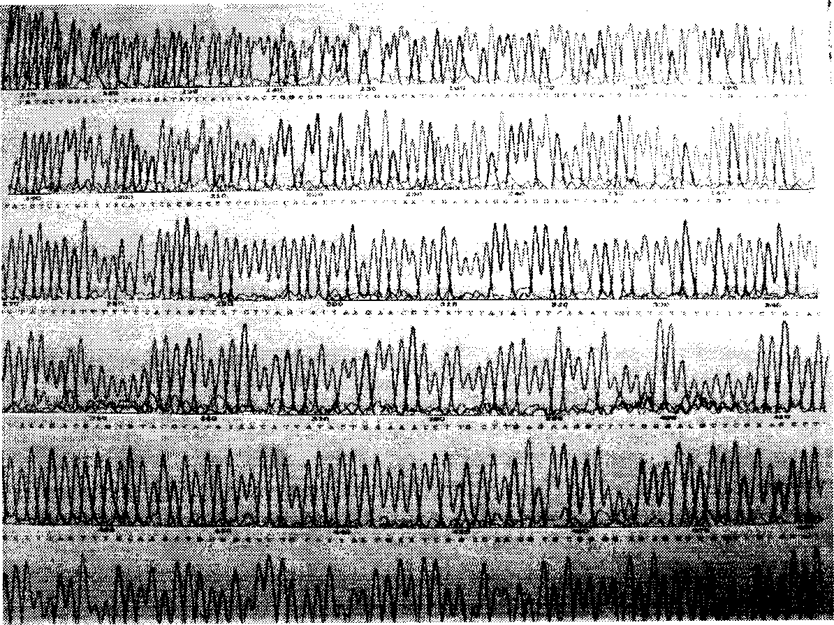 Method of expressing thymys peptide alpha by yeast and use thereof