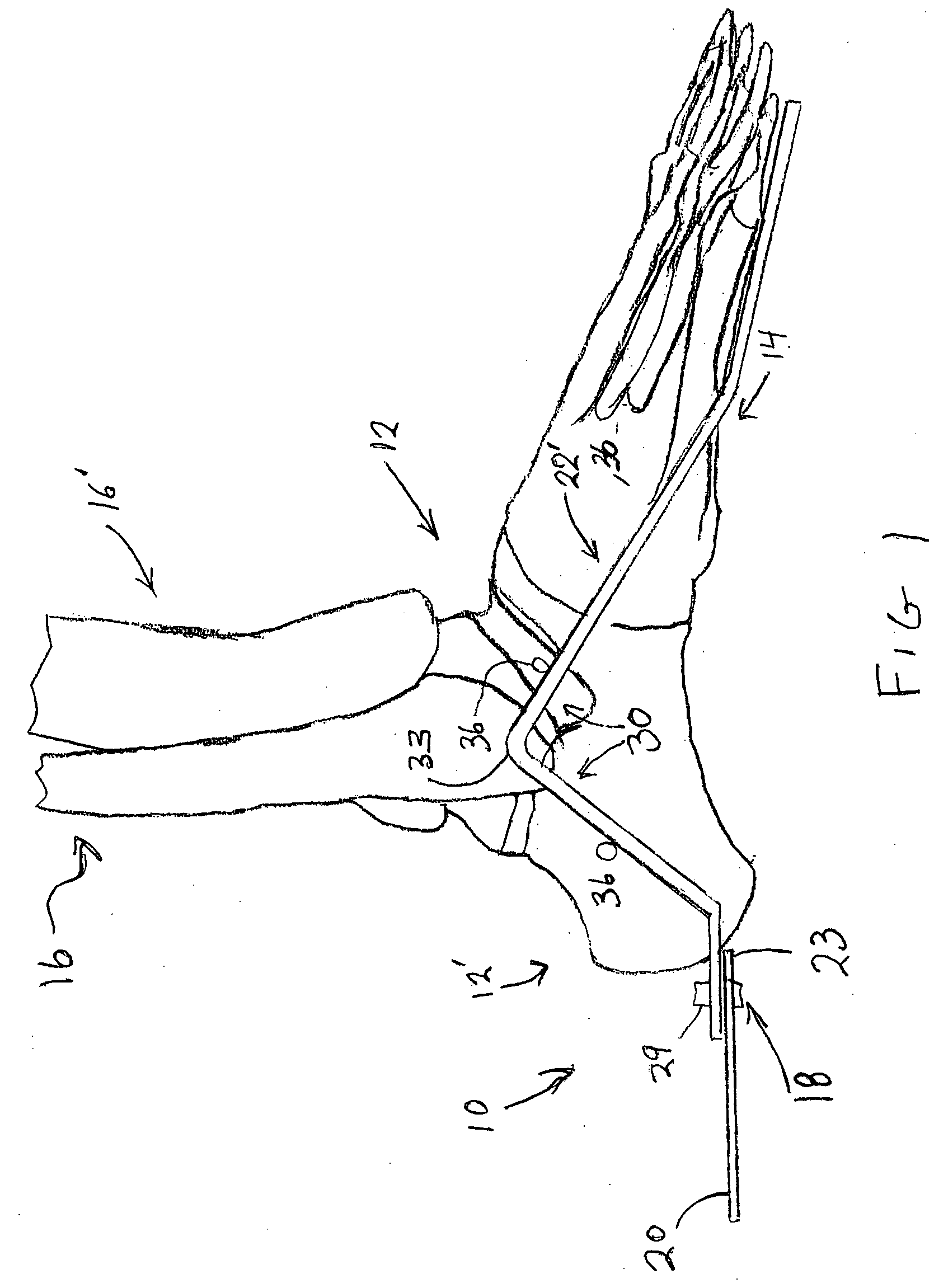 External fixator assembly