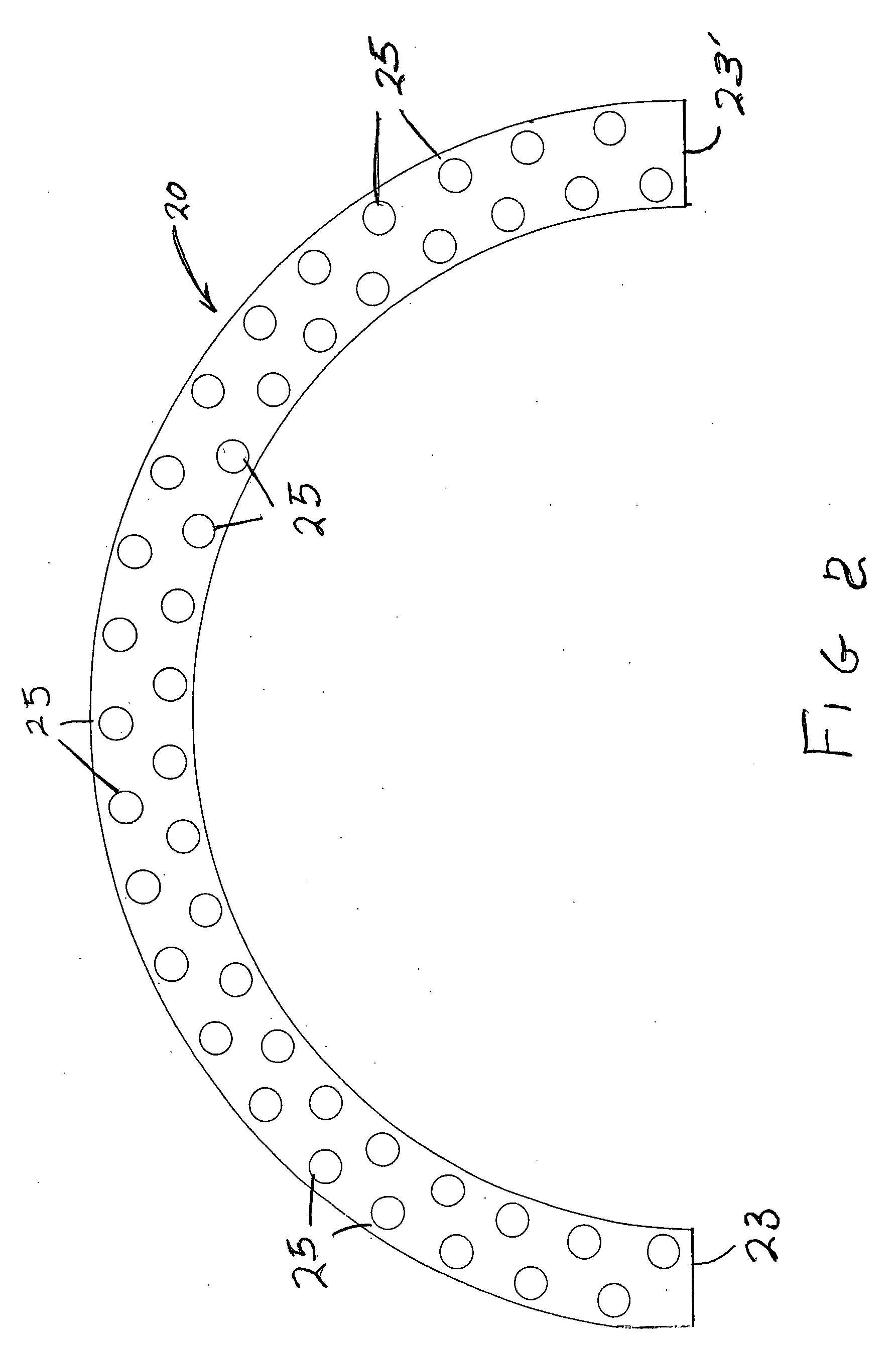 External fixator assembly