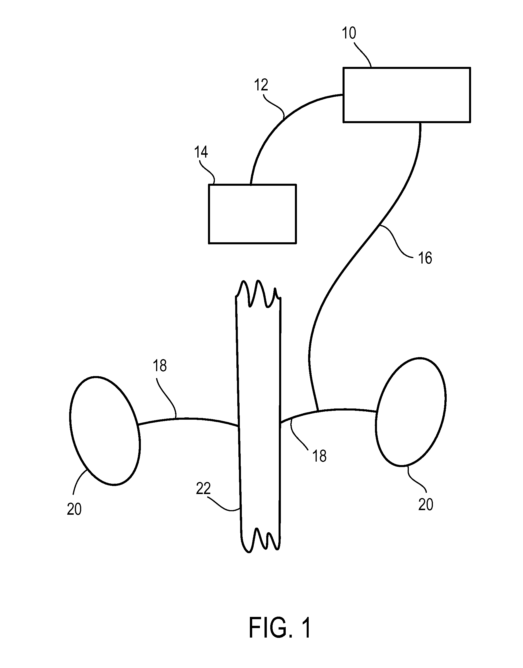 Methods and materials for treating syncope