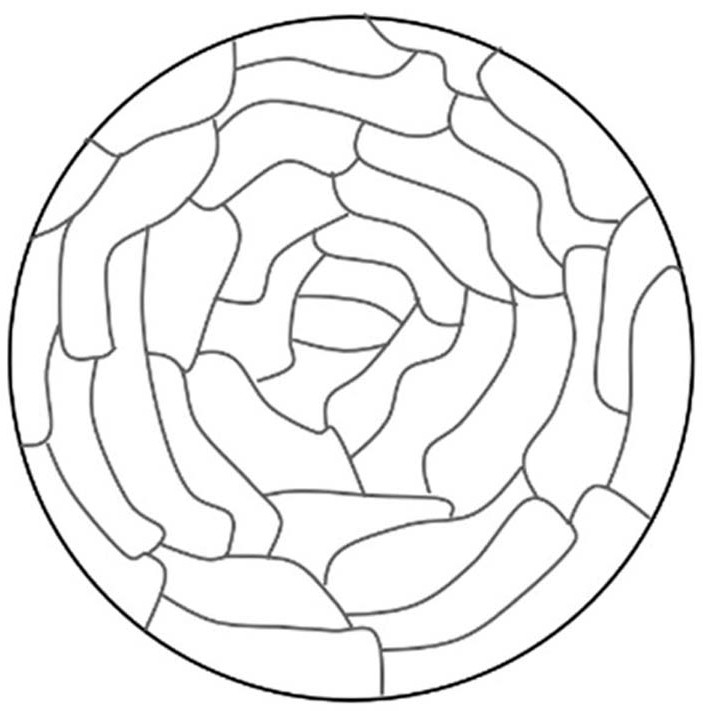 High-strength stainless steel wire for interventional medical treatment and preparation method thereof