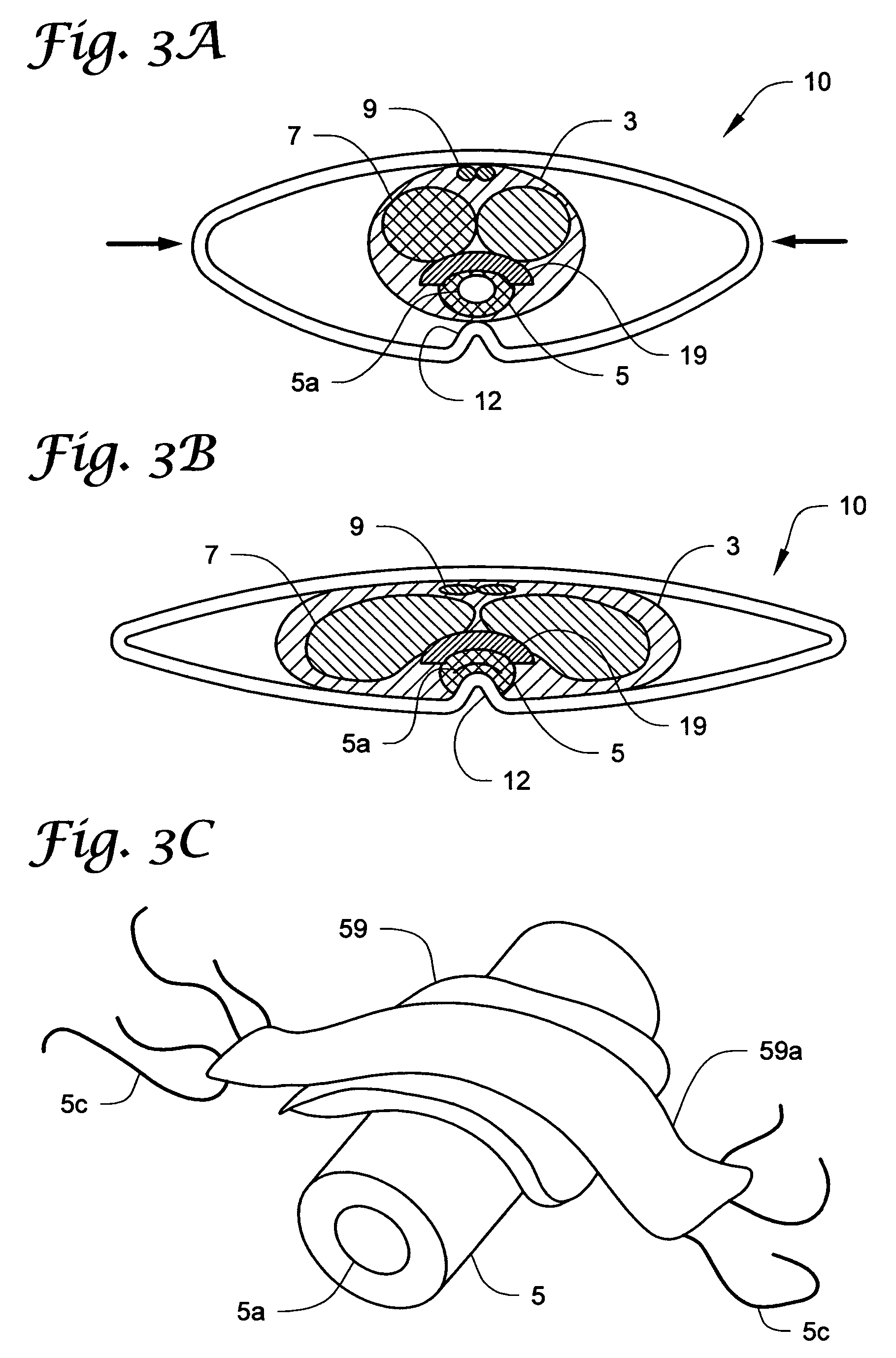 Penile compression device