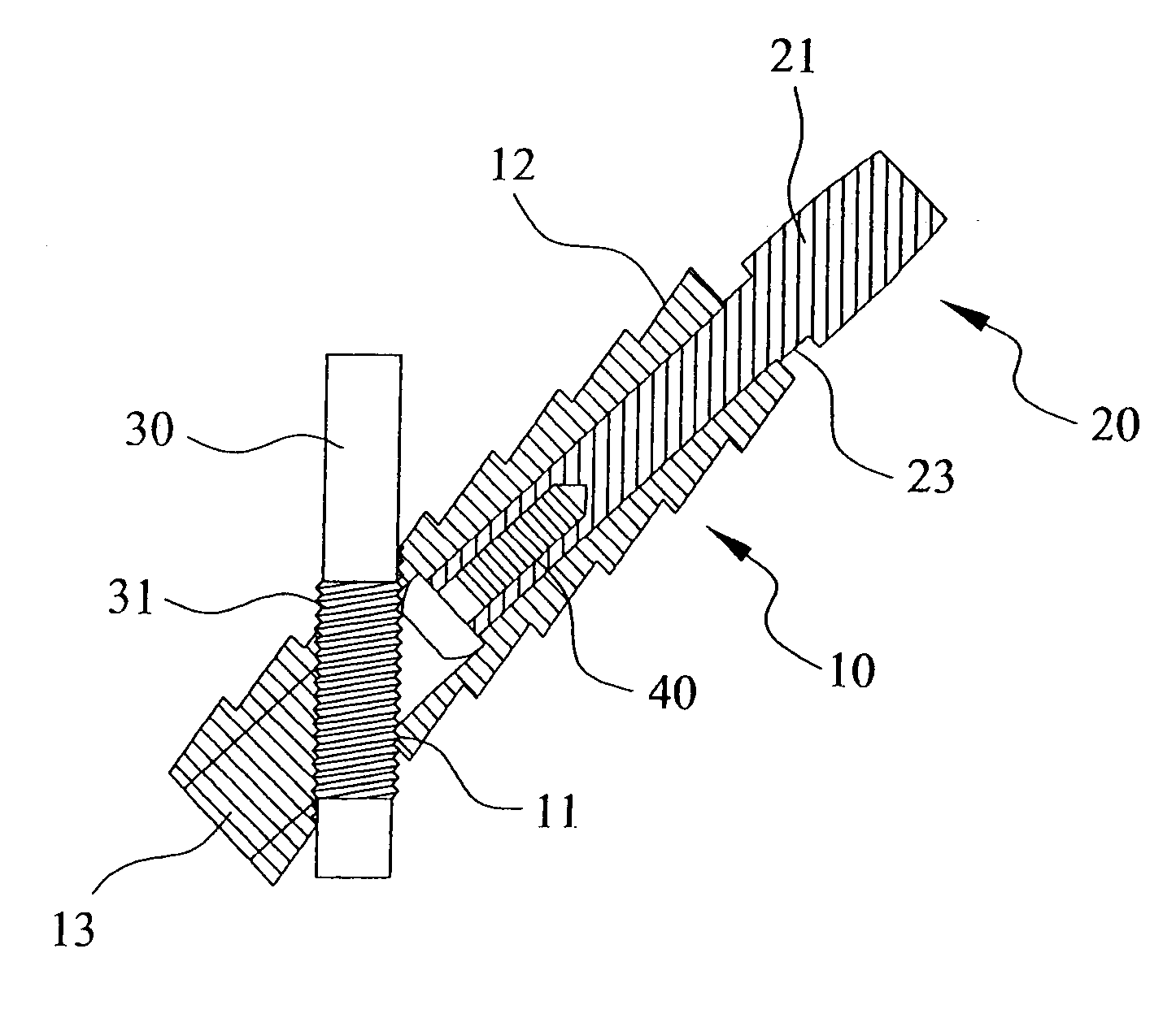 Thighbone shaft