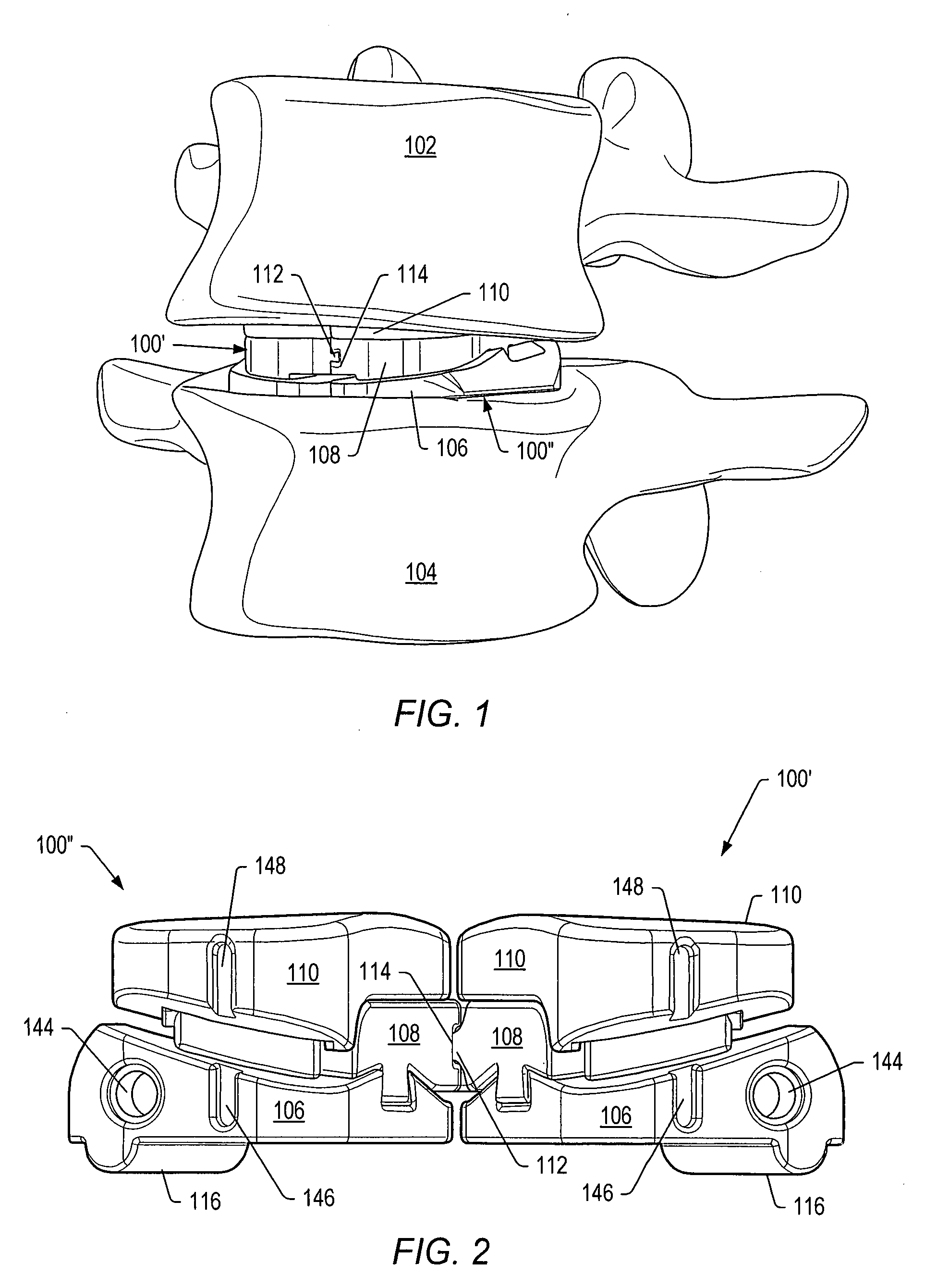 Dampener system for a posterior stabilization system with a variable length elongated member