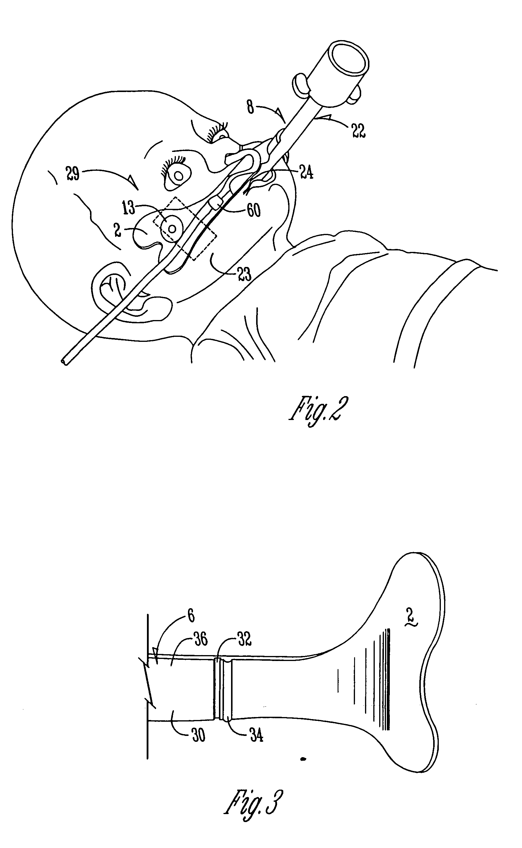 Nasal oral respiratory interface