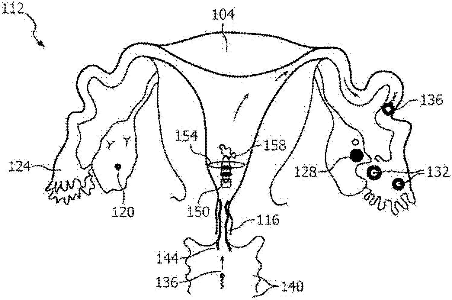 Intrauterine electronic capsule for administering a substance