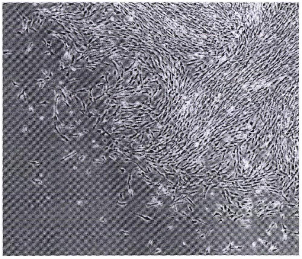 Novel coronavirus gene-silencing immortalized lung stem cell vector vaccine