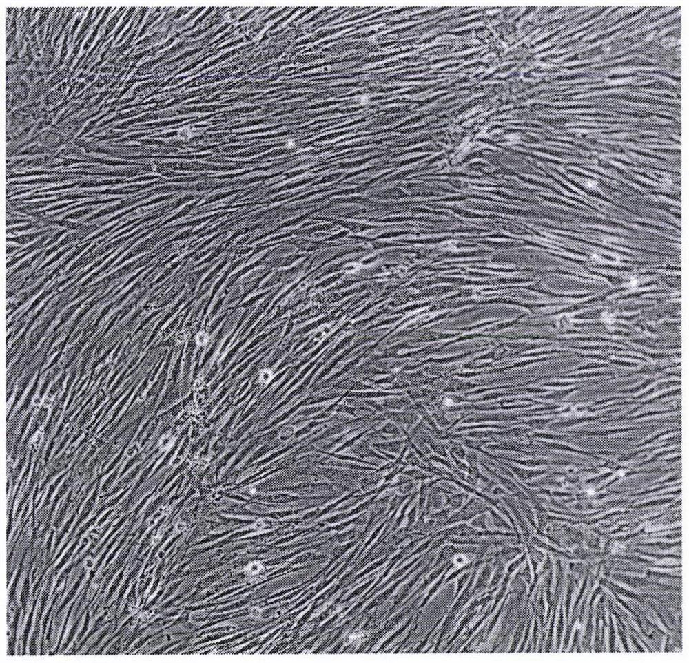 Novel coronavirus gene-silencing immortalized lung stem cell vector vaccine