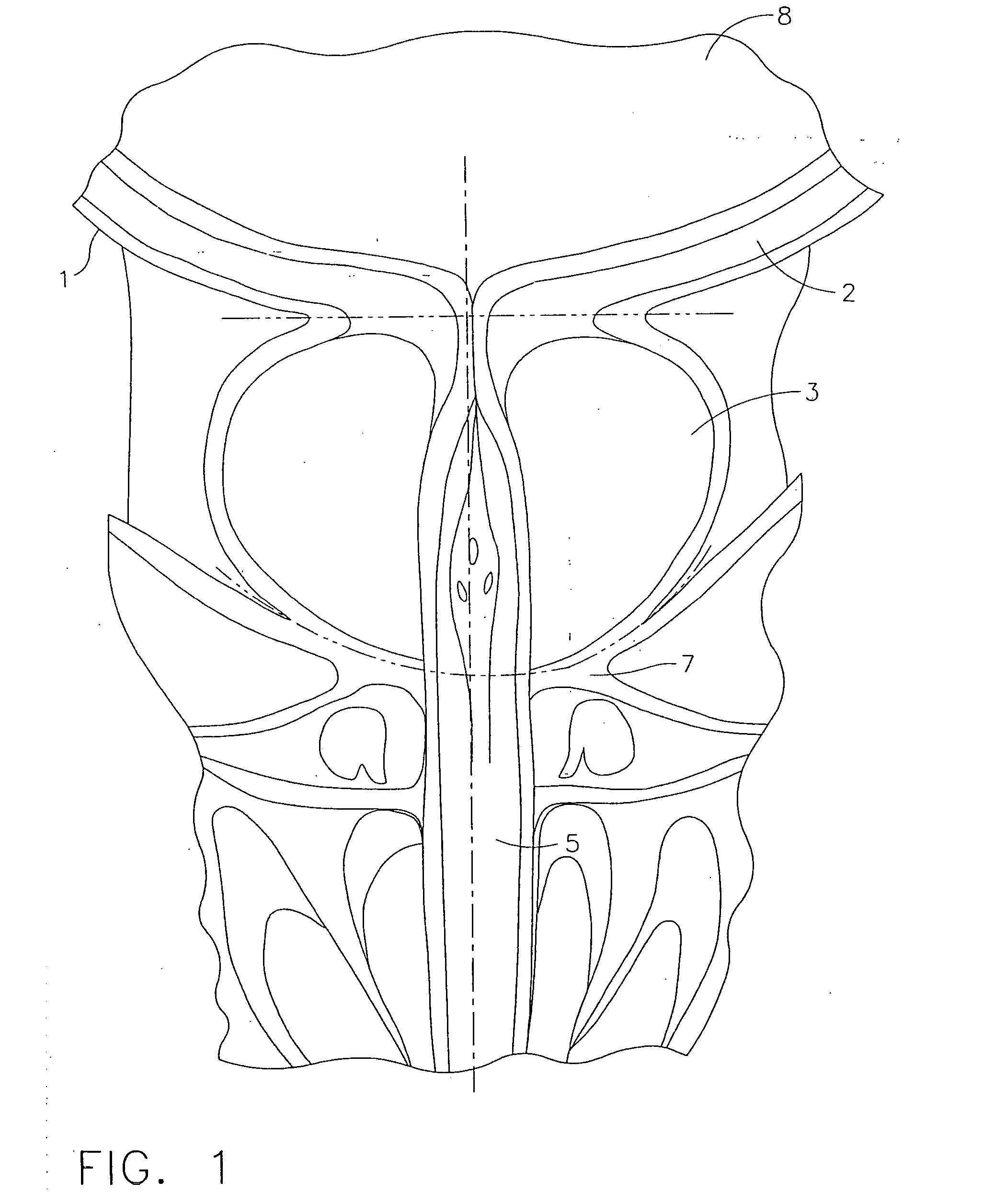 Method and instrument for effecting anastomosis of respective tissues defining two body lumens