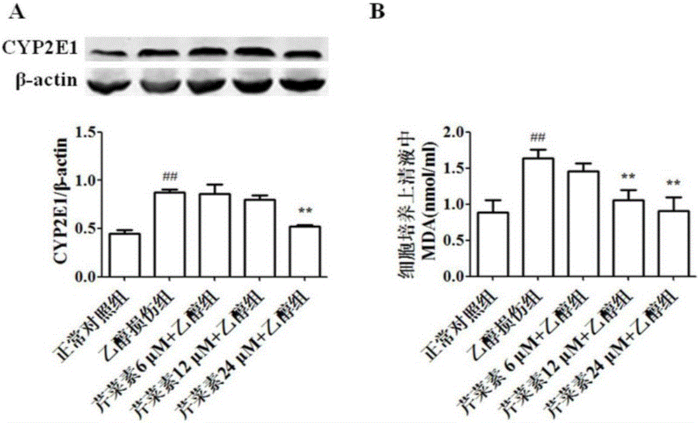 Application of apigenin in preparing medicines or health care foods for preventing and/or treating alcoholic liver injury