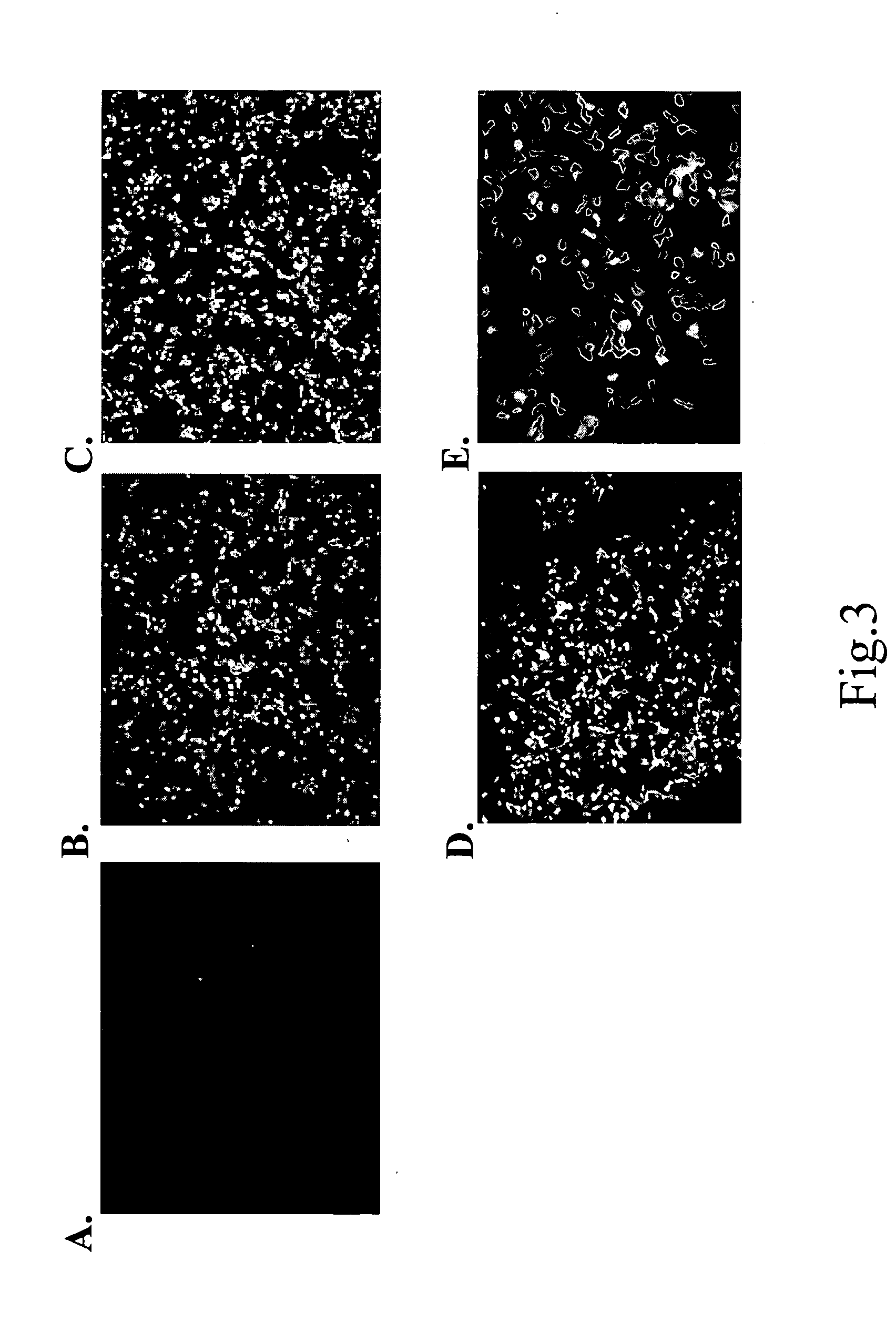 Human soluble neuropilin-1 primary polyadenylation signal and uses thereof