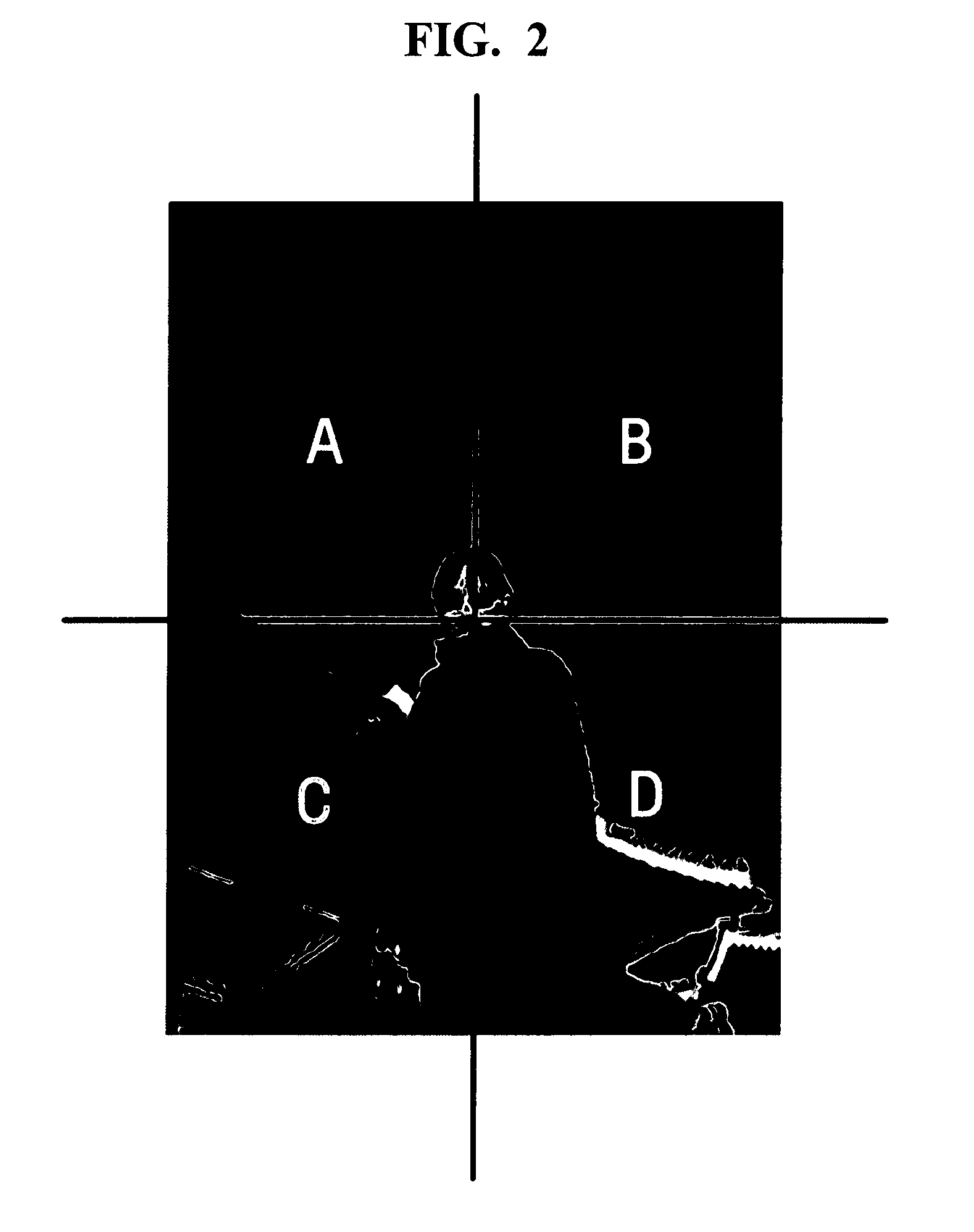 Method, medium, and system compensating shadow areas