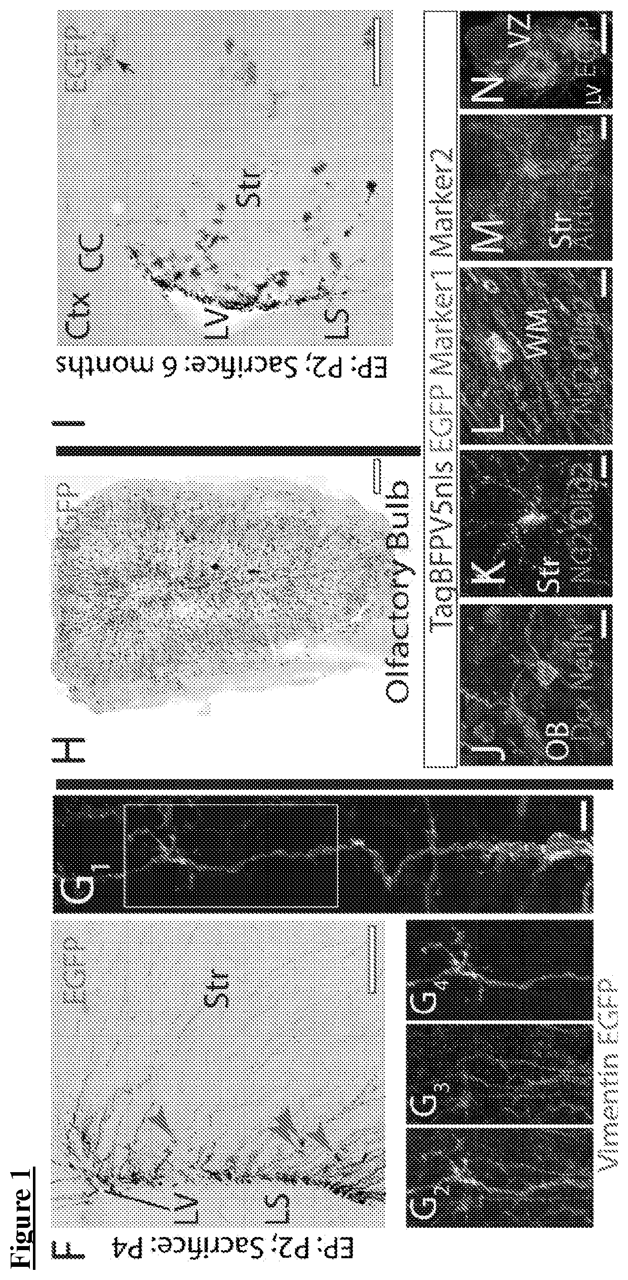 ETS factors regulate neural stem cell depletion and gliogenesis in Ras pathway glioma