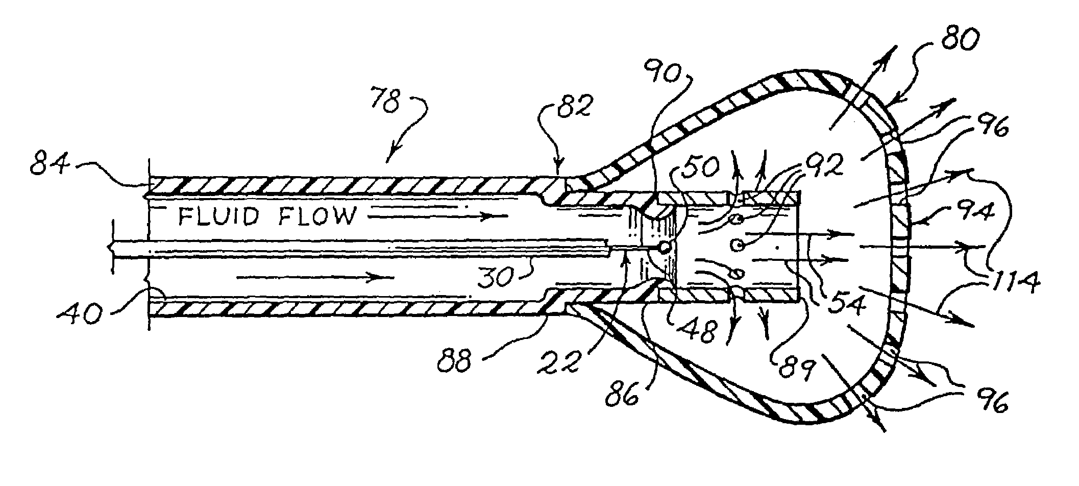 Electrophysiology energy treatment devices and methods of use