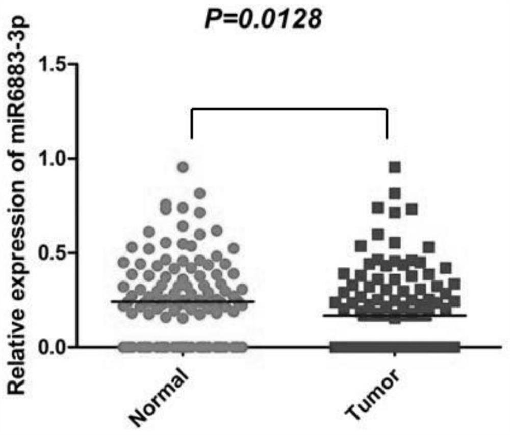 Application of miR-6883-3p in preparation of anti-liver cancer or liver cancer prognosis evaluation product