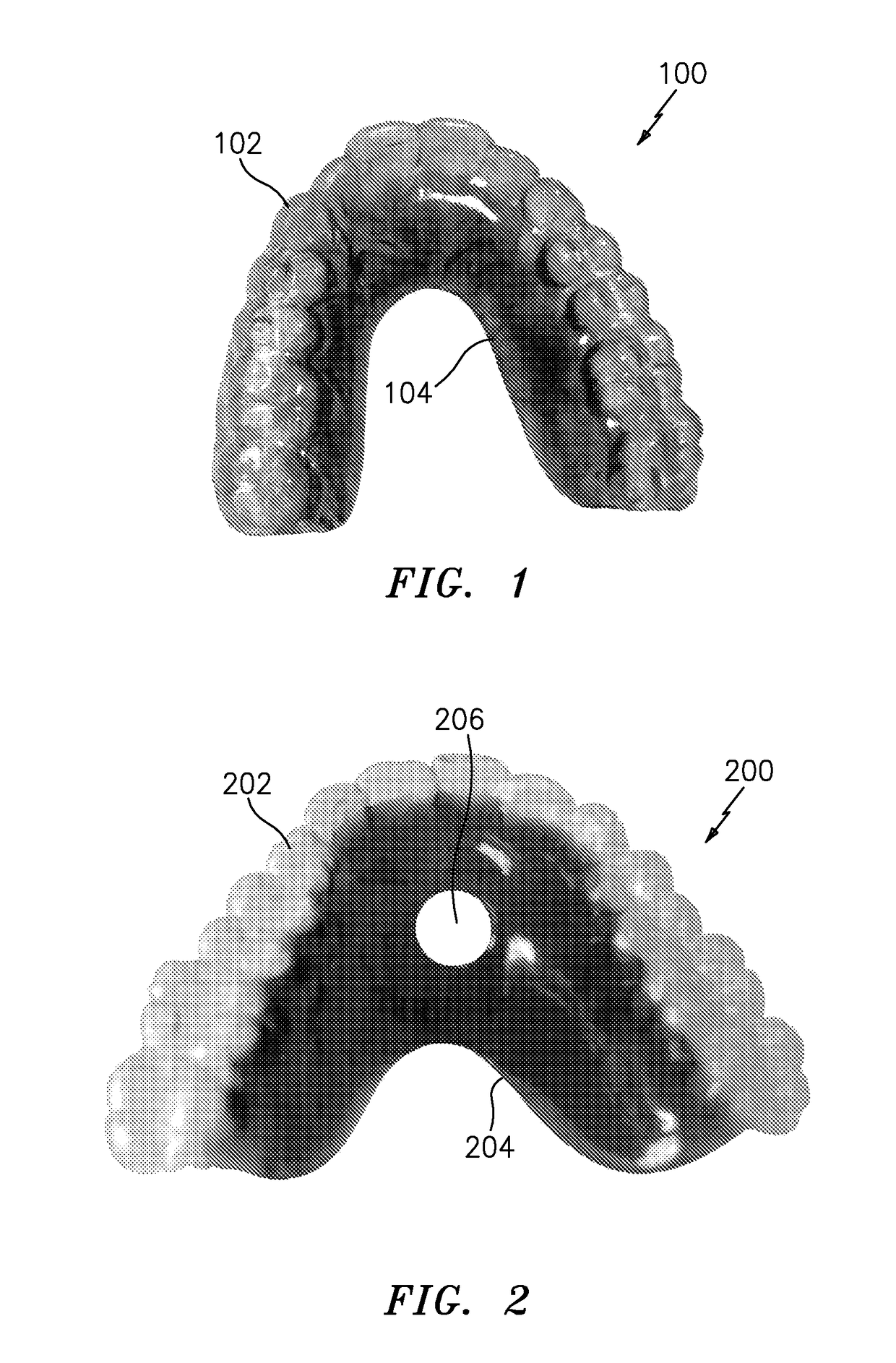 Hybrid orthodontic appliance