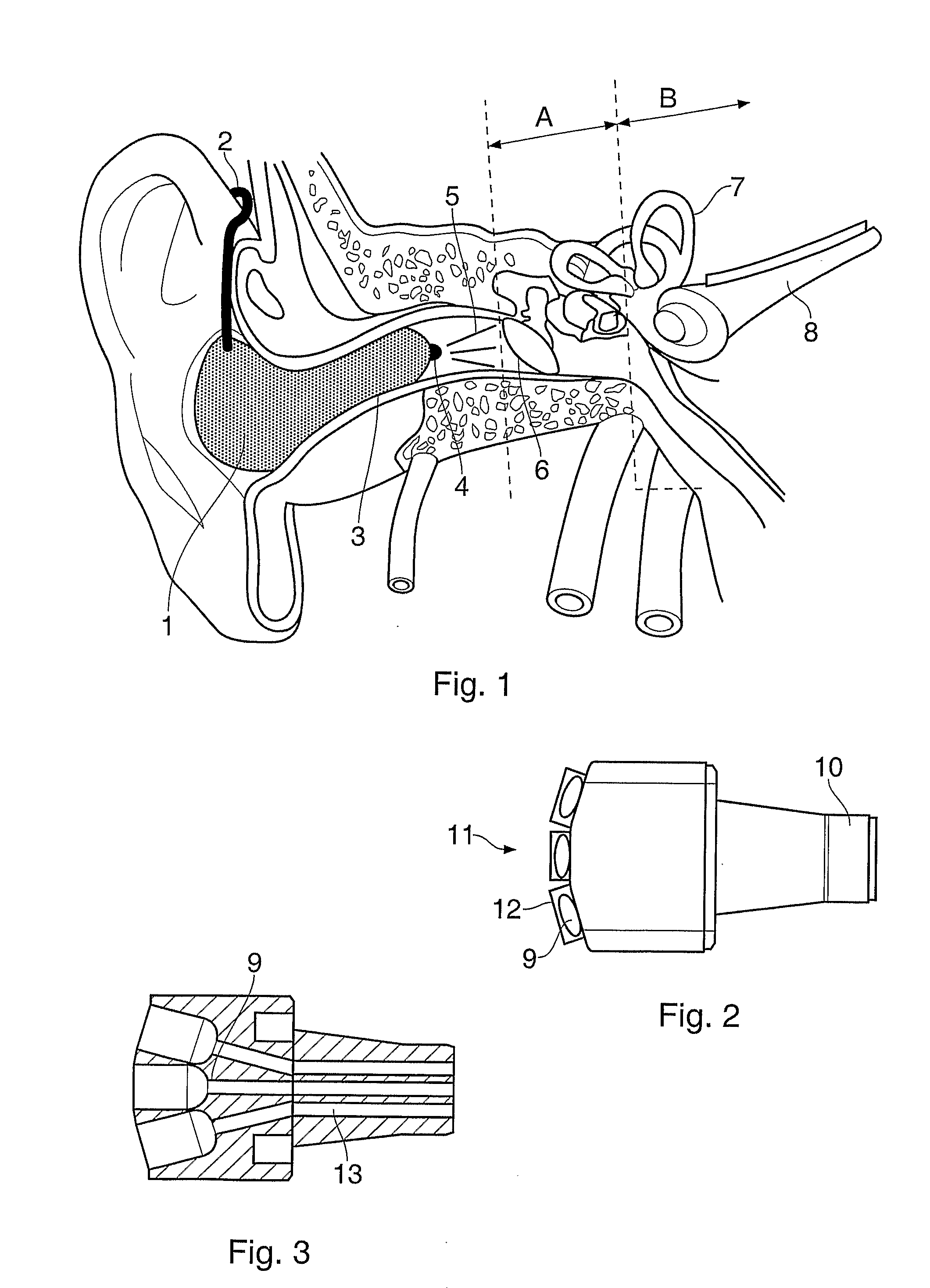 Use of Electromagnetic Radiation in the Treatment of Sensory Organs