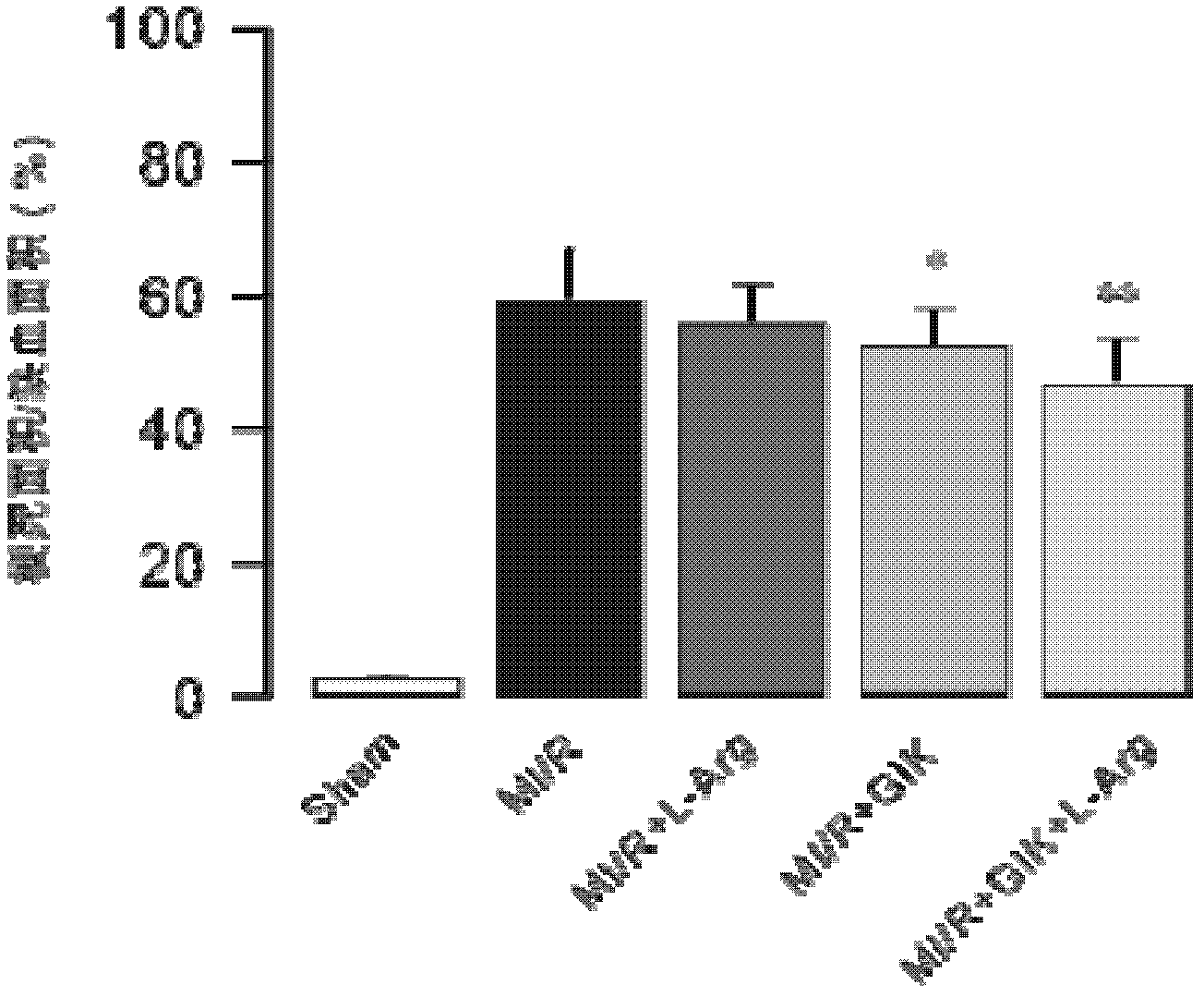 L-arginine-glucose-insulin-potassium chloride composition and application thereof