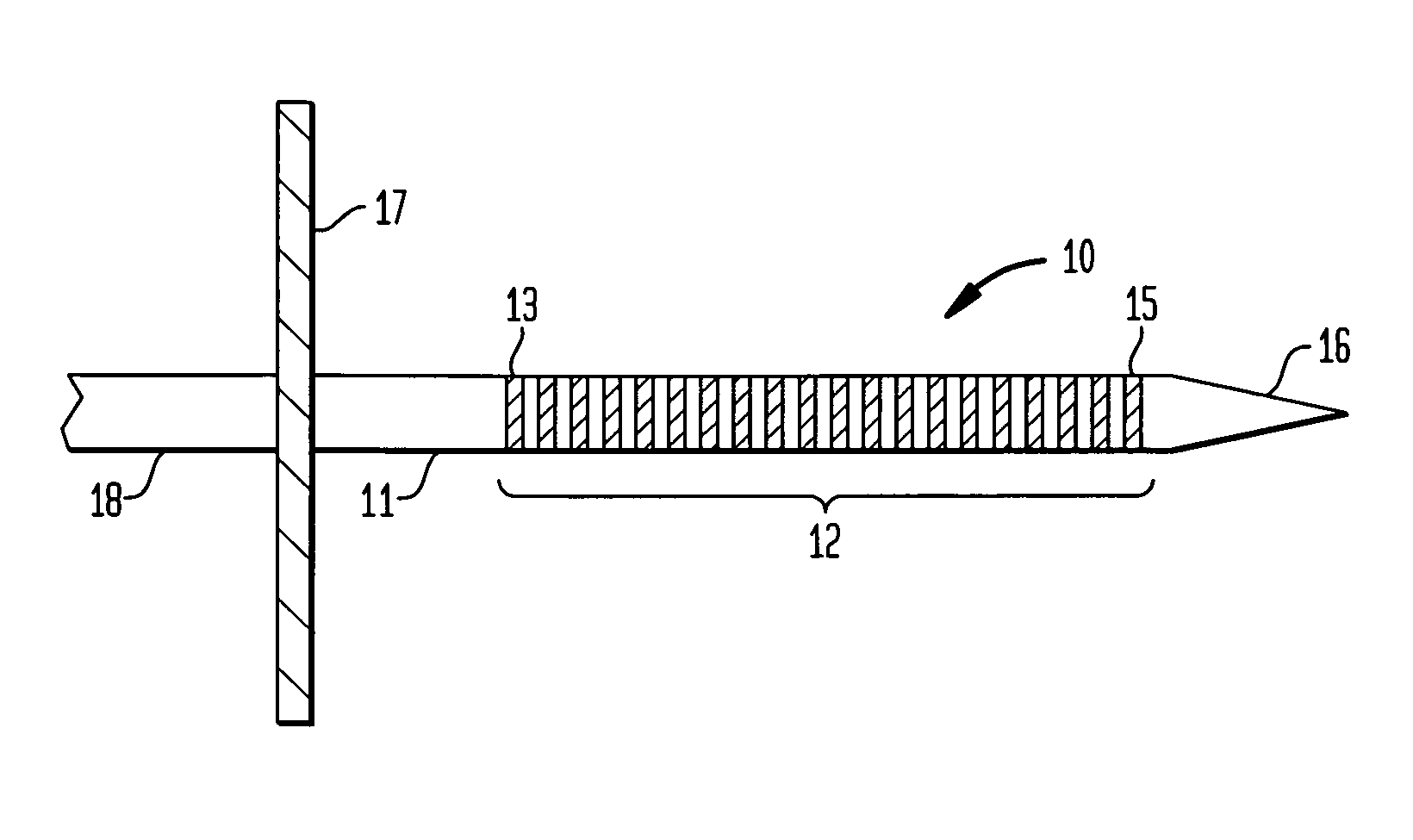 Auditory midbrain implant