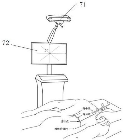 Portable puncture outfit and puncture device and method composed of same