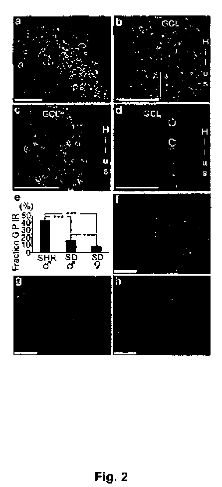 Use of compounds having gip activity for the treatment of disorders associated with abnormal loss of cells and/or for the treatment of obesity