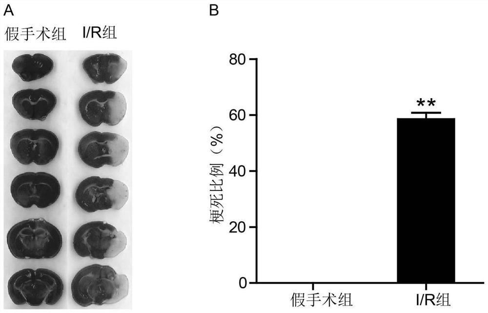 Application of CD74 protein in preparation of kit for identifying macrophage subsets in brains after ischemic injury