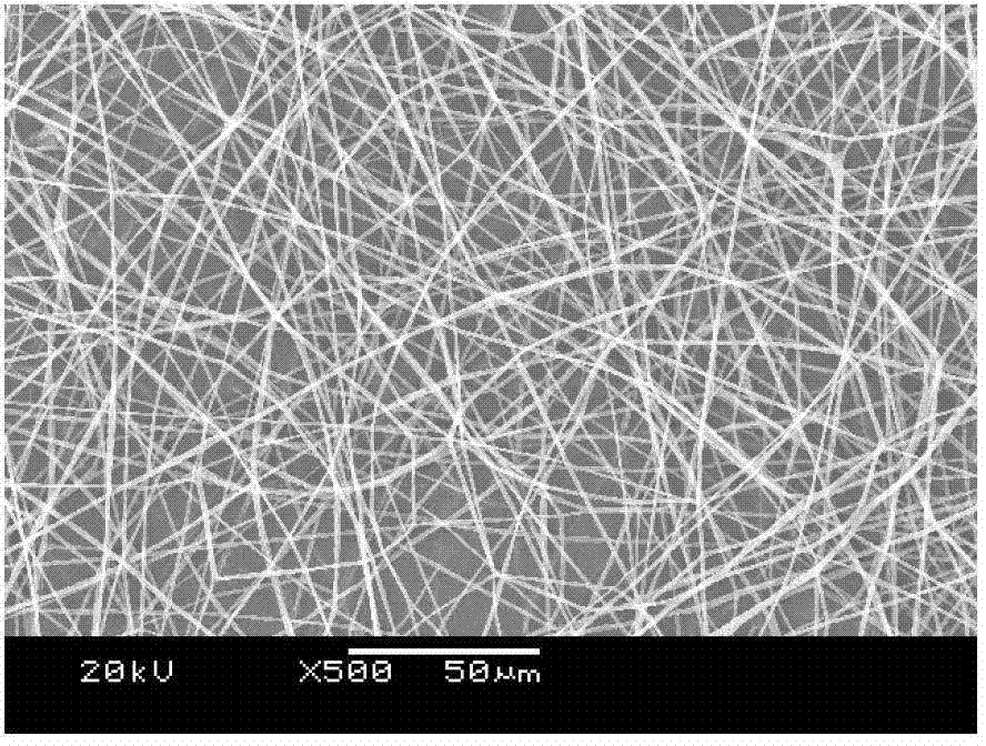 Novel double-layered composite transmitting tissue regeneration membrane and preparation method thereof