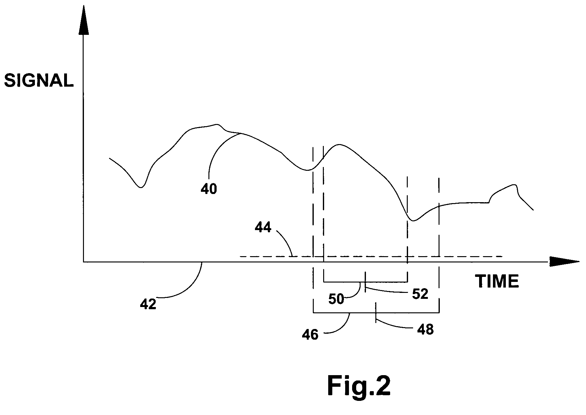 System for detection and estimation of periodic patterns in a noisy signal