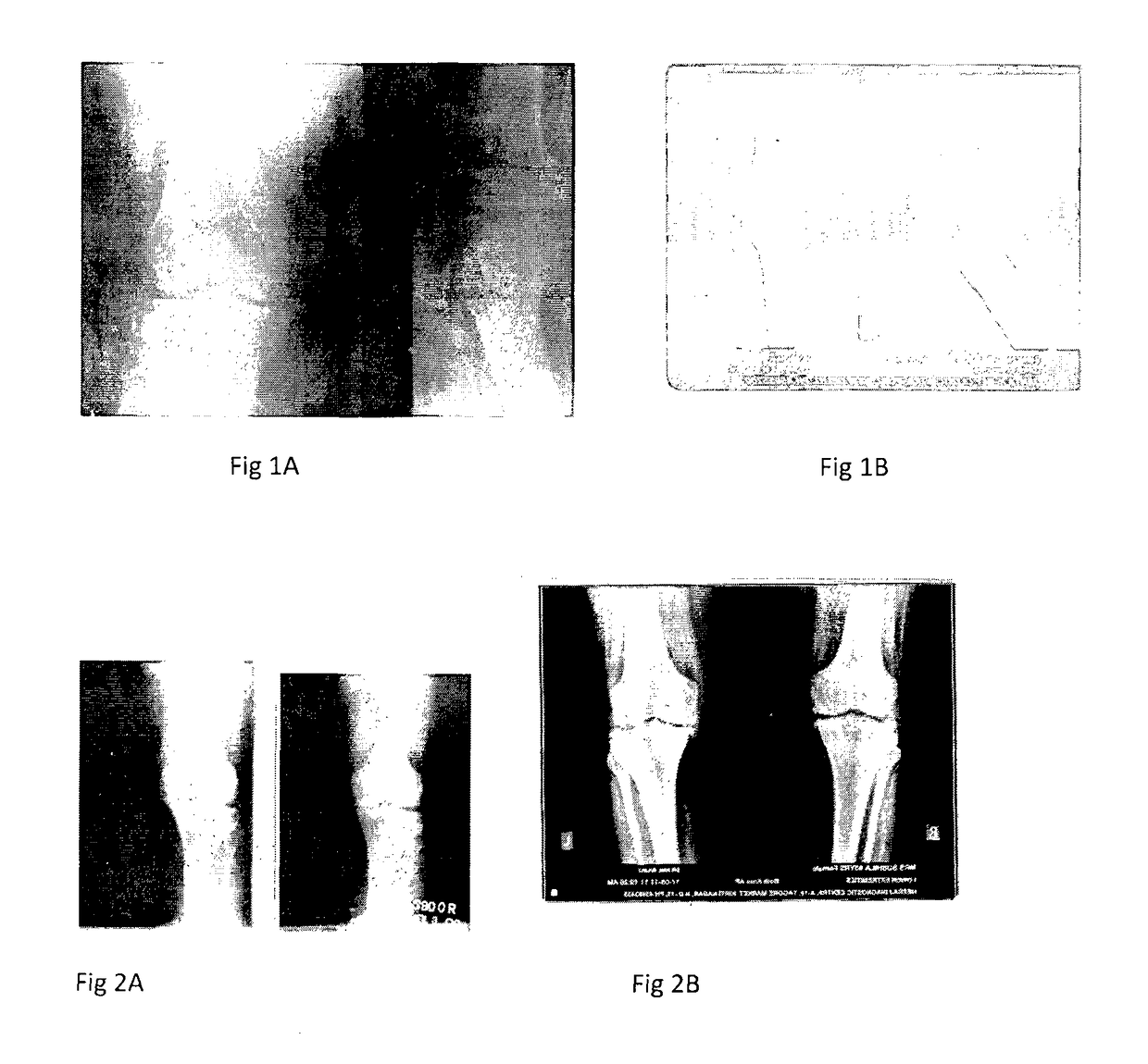 A novel synergistic herbal formulation for degenerative disease cardiovascular diseases, autoimmune, inflammatory and metabolism disorder and the process of preparing the same