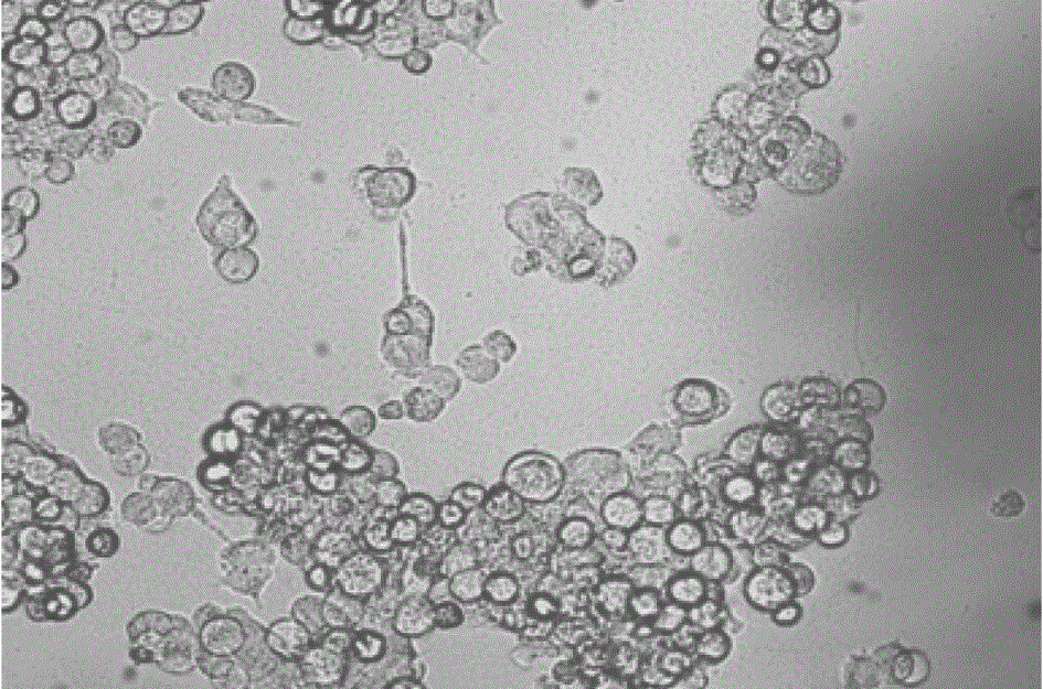 Recombined Ad-TNFR2 shRNA adenoviridae and construction and application thereof