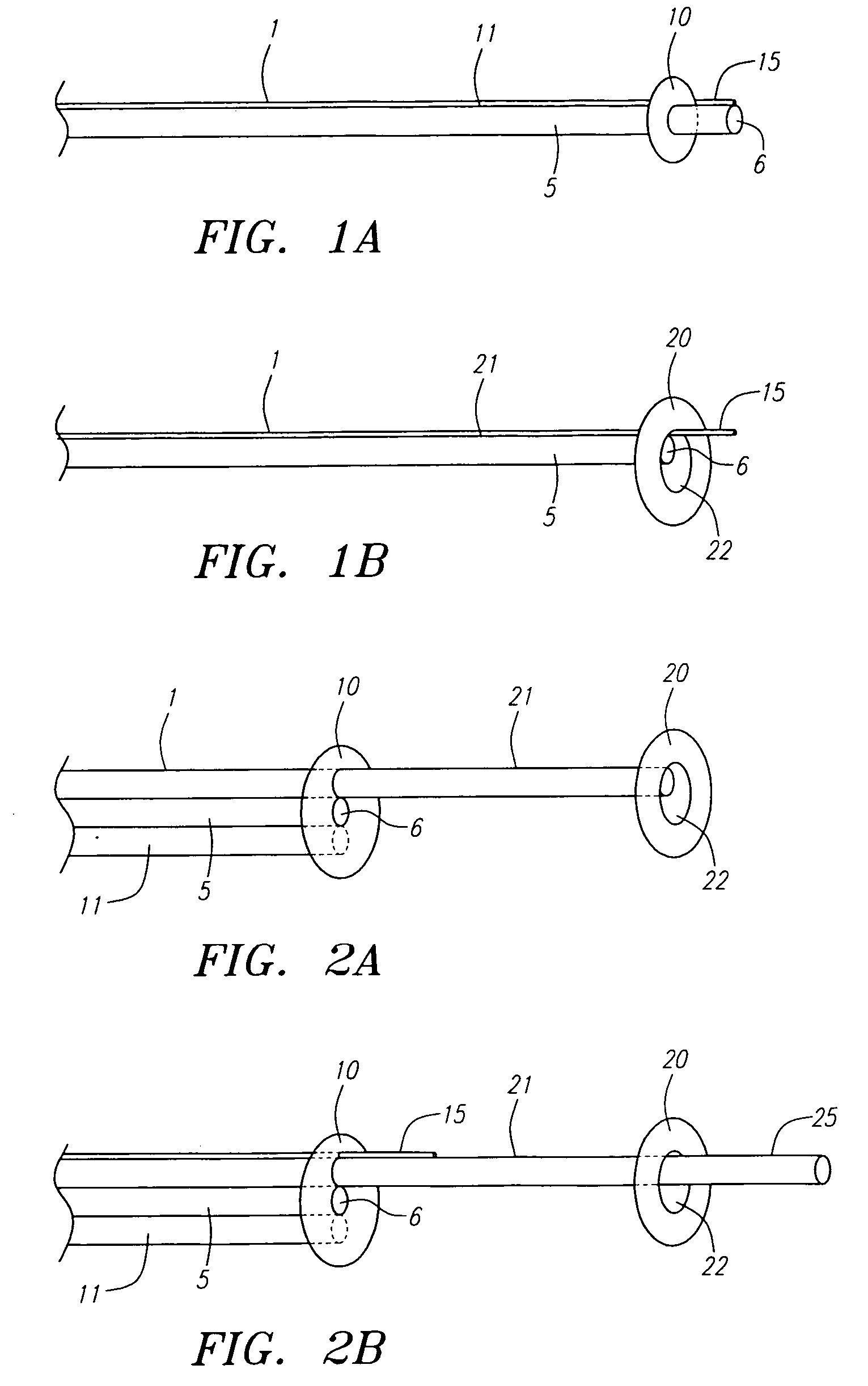 Devices and methods for preventing distal embolization using flow reversal in arteries having collateral blood flow