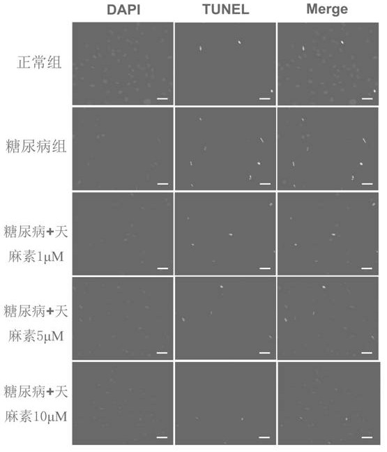 Application of gastrodin in the use of titanium metal in traditional Chinese medicine in diabetic environment