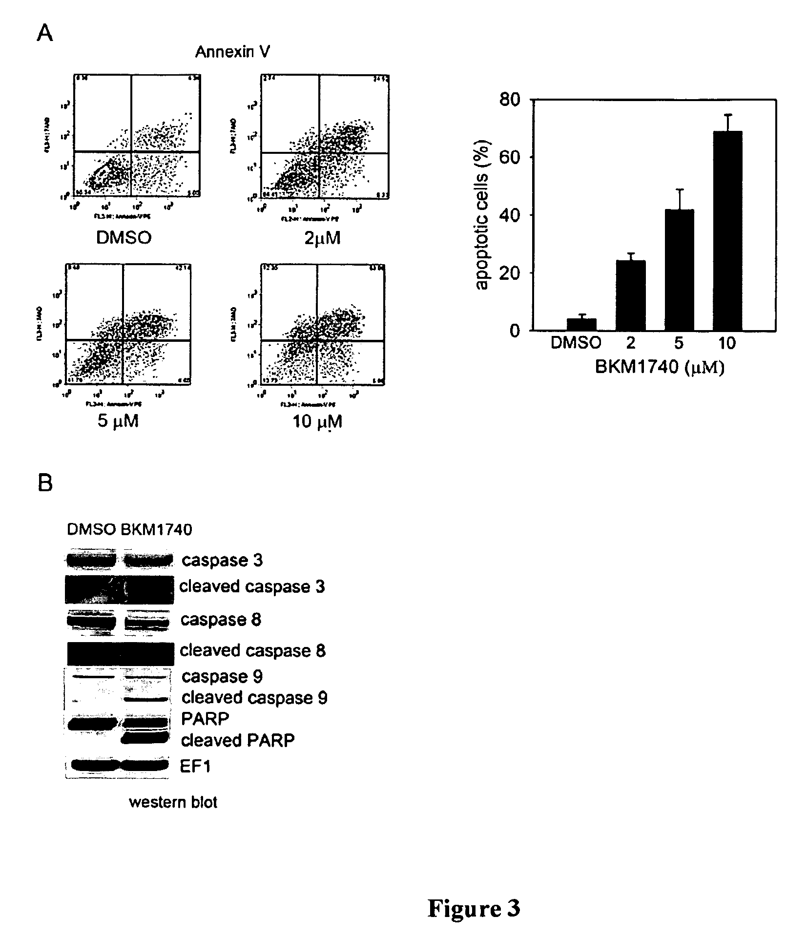 Compositions and methods for treating bone cancer