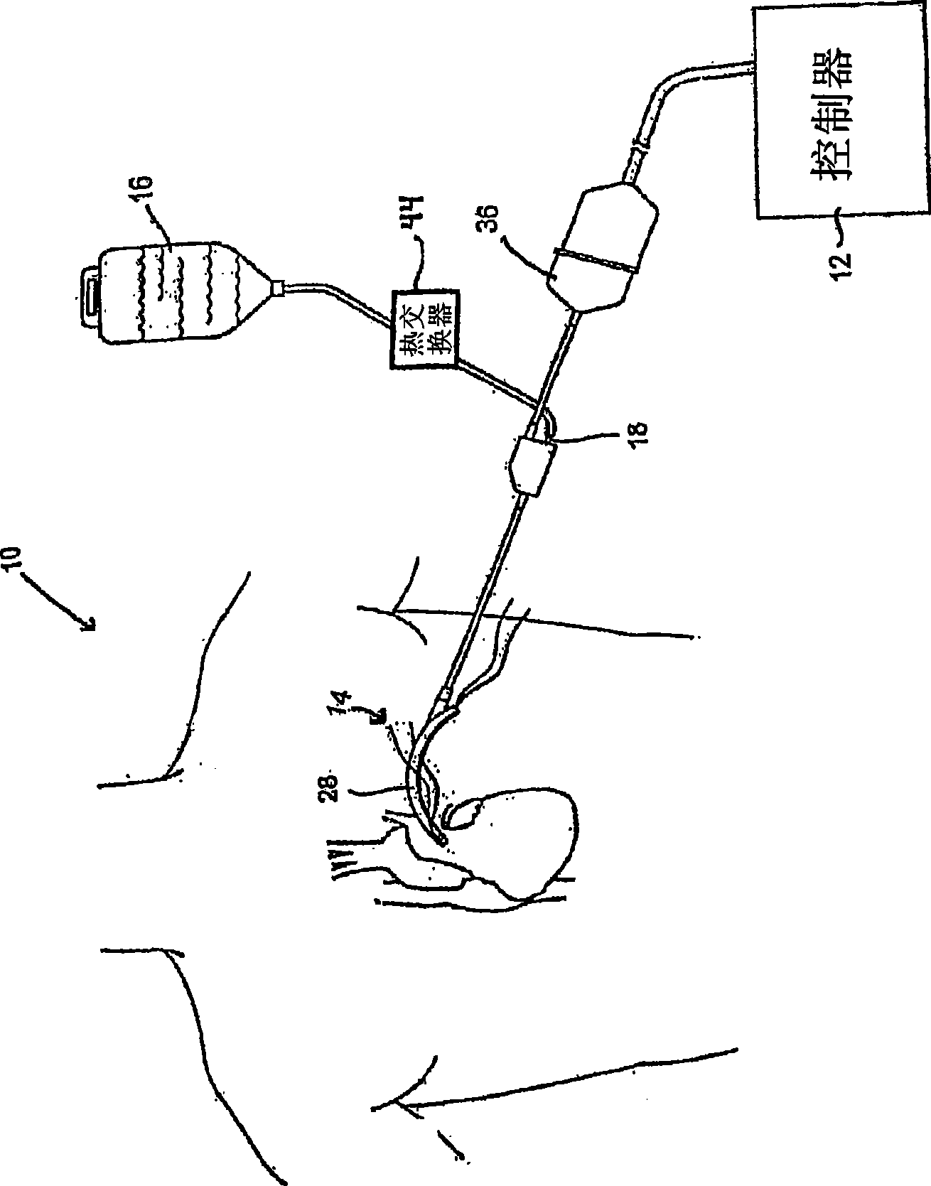 Apparatus and method for ablating tissue