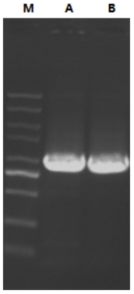 Immobilized transaminase and application of immobilized transaminase in synthesis of sitagliptin intermediate