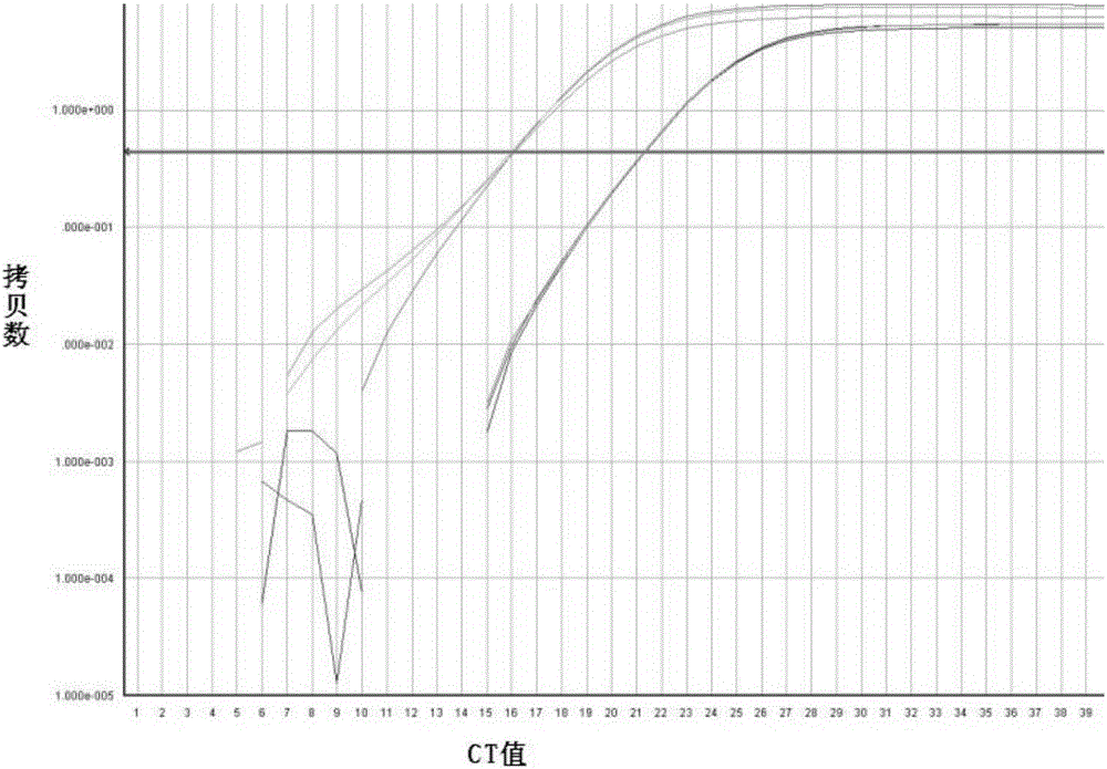 Specific primer pair for detecting expression level of human PAK2 gene and application thereof