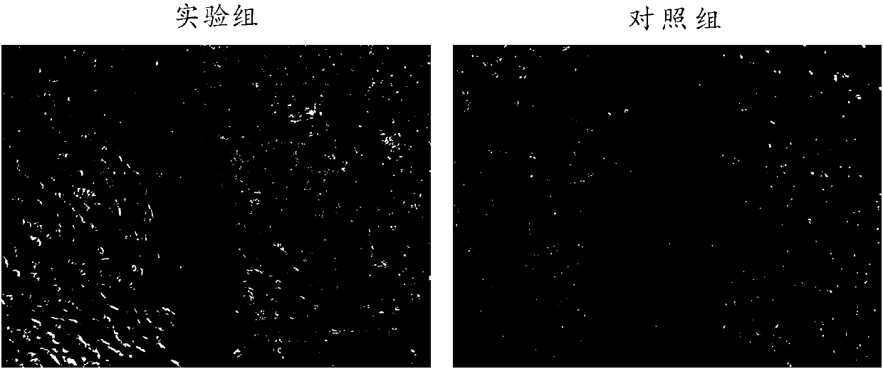 Application of magnesium chloride solution to preparation of medicines for treating osteoarticular diseases