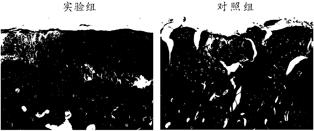 Application of magnesium chloride solution to preparation of medicines for treating osteoarticular diseases