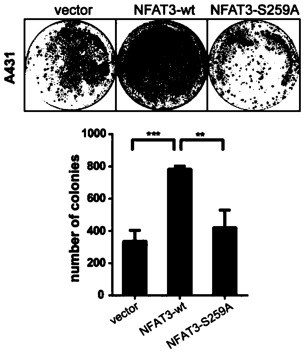 Phosphorylated nfat3 mutants and their applications