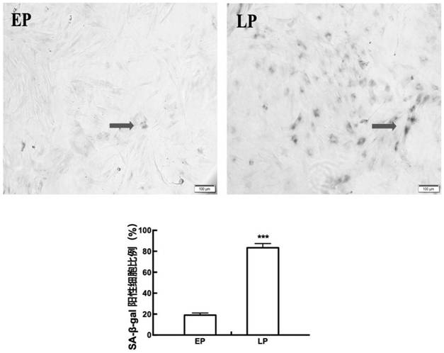 Application of reagent capable of overexpressing muscle phosphofructokinase in preparation of medicine for delaying cell senescence