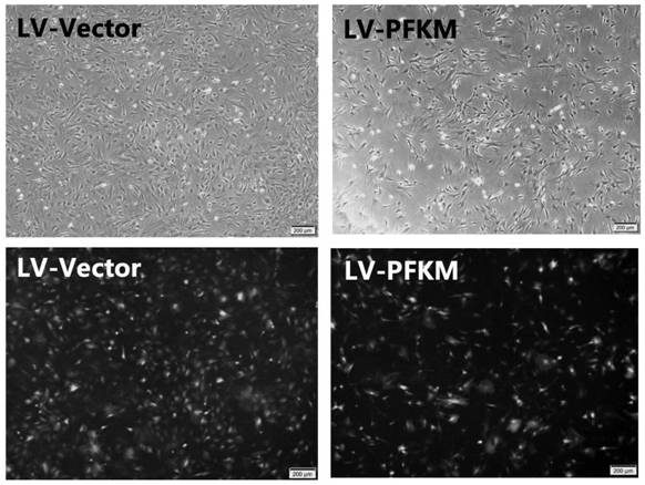 Application of reagent capable of overexpressing muscle phosphofructokinase in preparation of medicine for delaying cell senescence