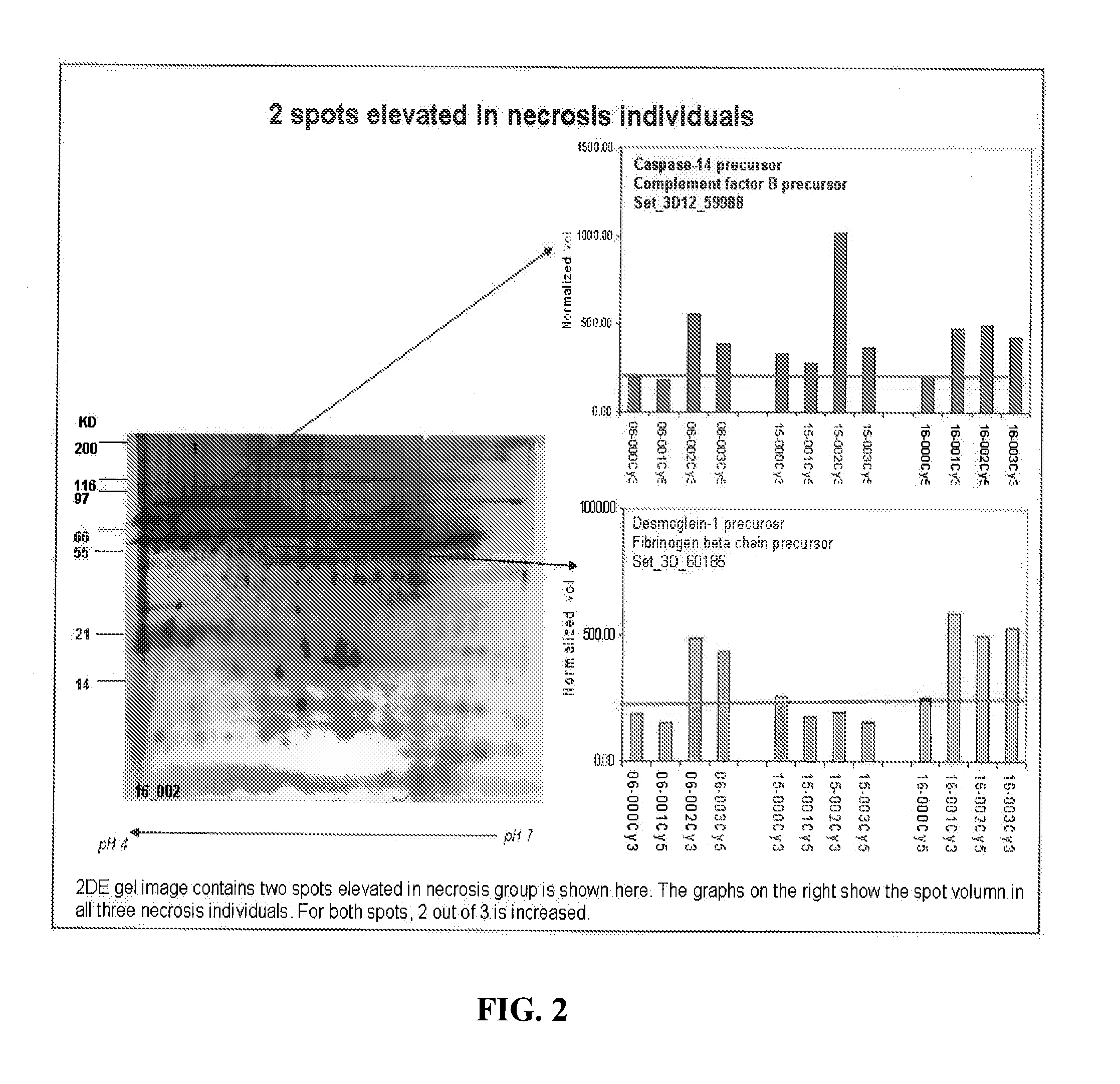 Biomarkers for myocardial ischemia