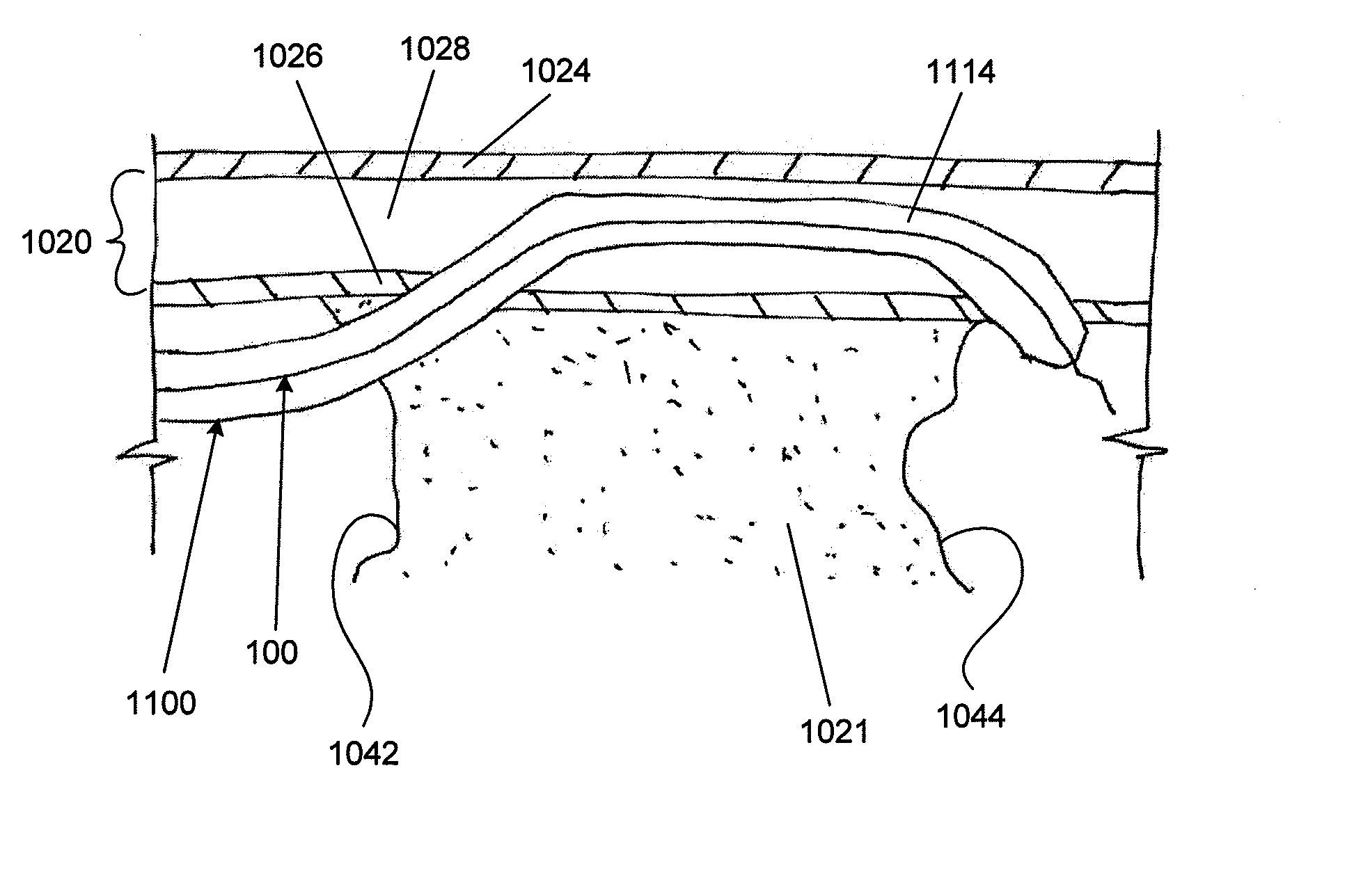 Re-entry stylet for catheter