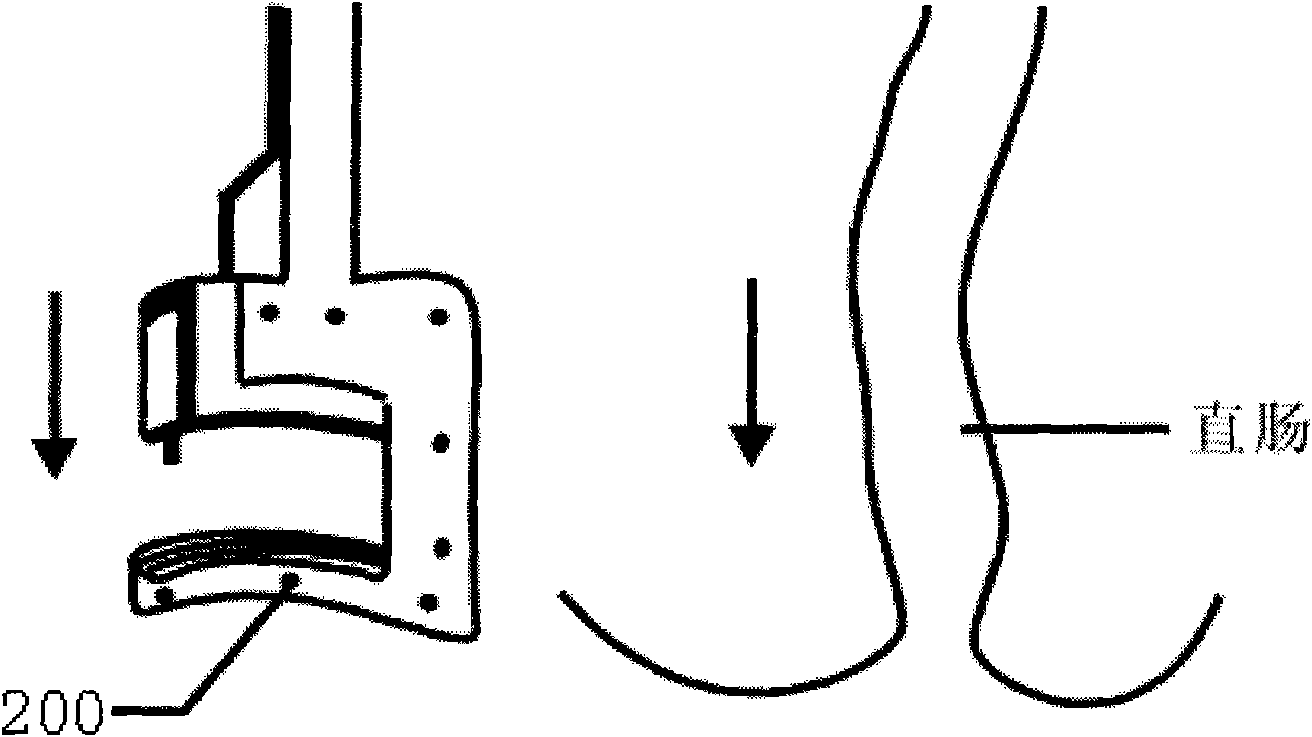 Incision stitching instrument