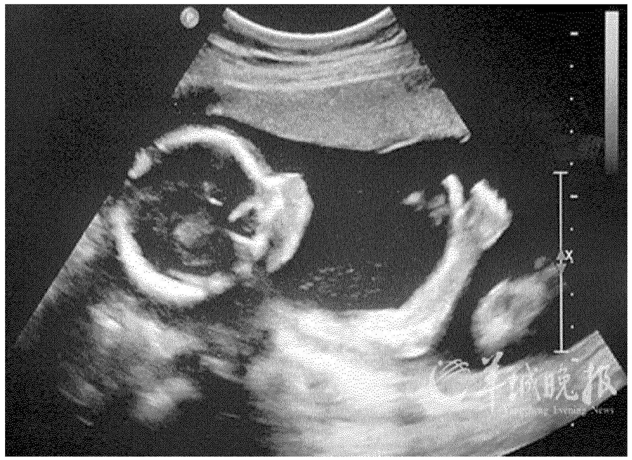 Fetal imaging system and method