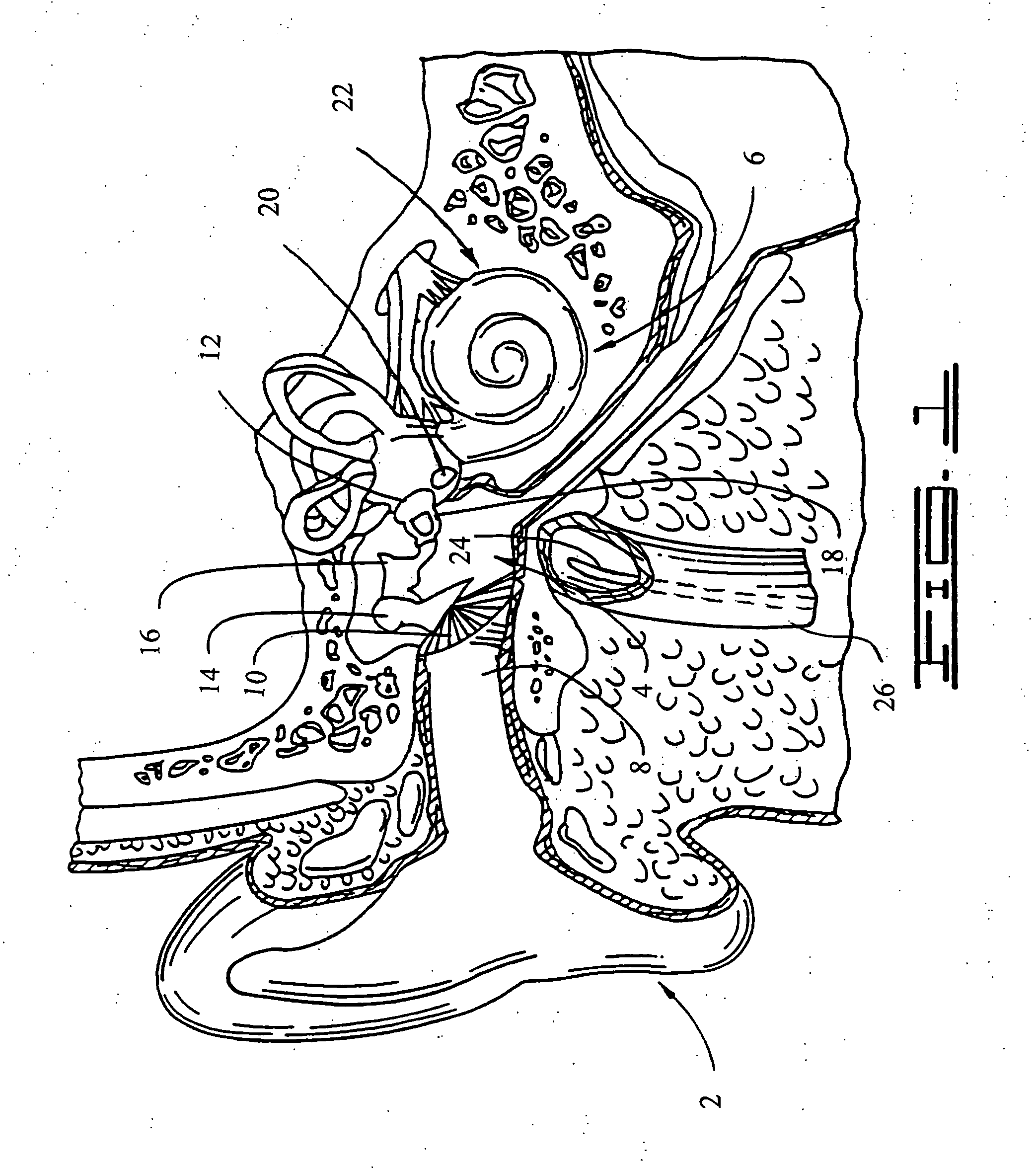 Otologic nanotechnology