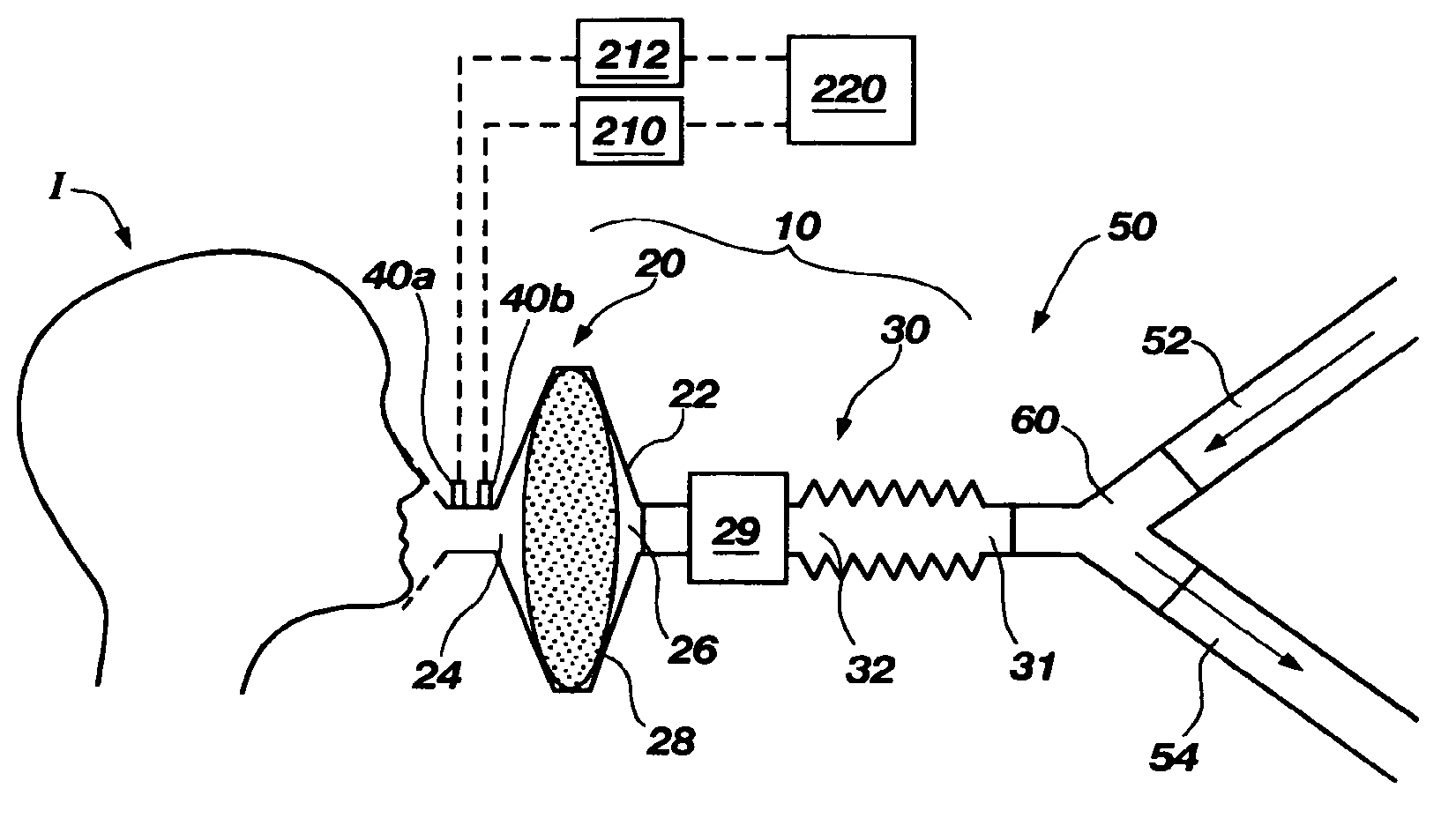 Apparatus and techniques for reducing the effects of general anesthetics